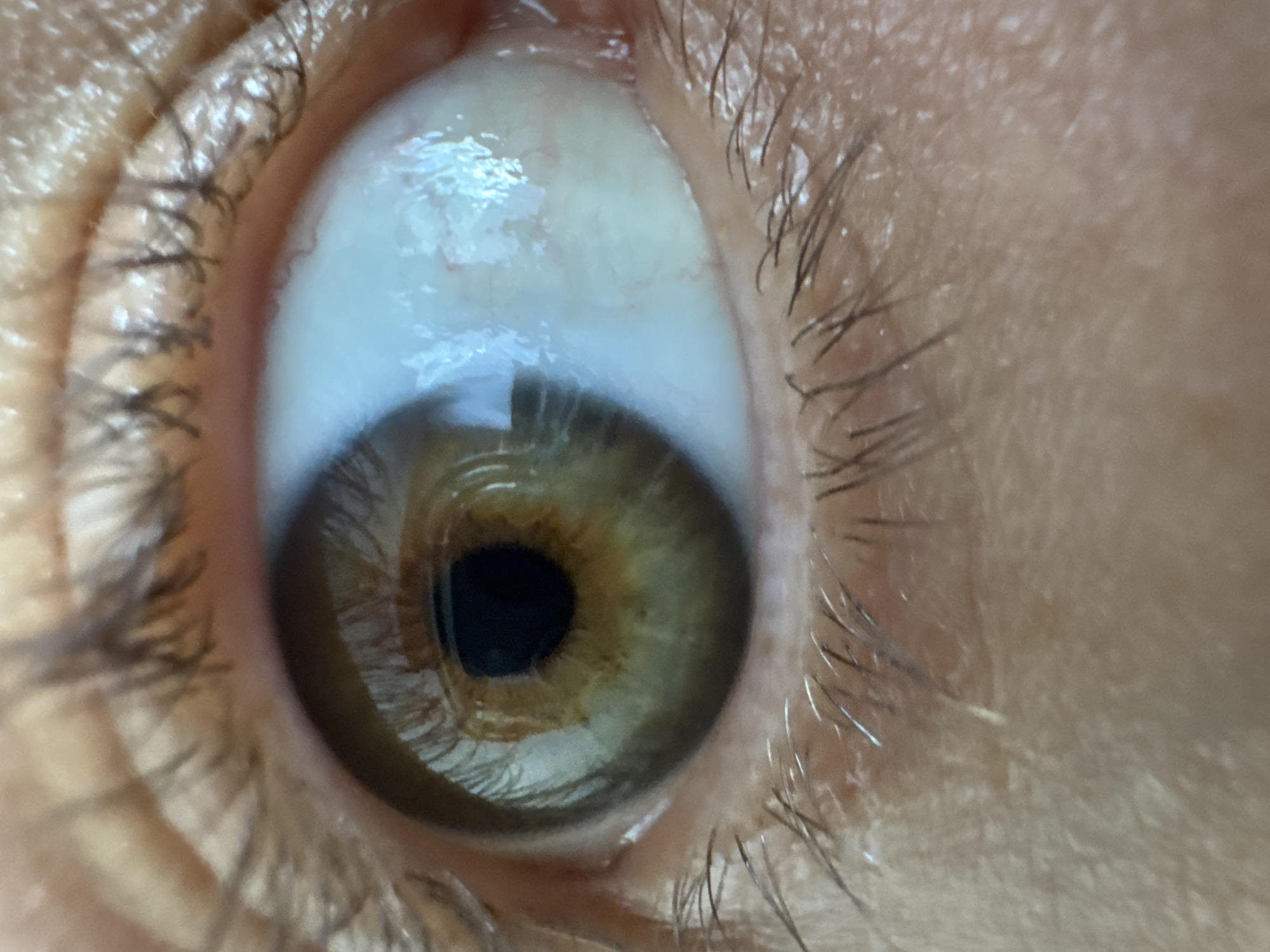 A close-up photograph shows a human eye with a light brown iris and a visible black pupil. The surrounding sclera is pale with minor blood vessels visible. The eyelashes and skin around the eye are detailed, showing individual hairs and skin texture. There is no indication of location within Kuta Selatan, Indonesia, or any other environmental context. No actions or interactions are depicted.