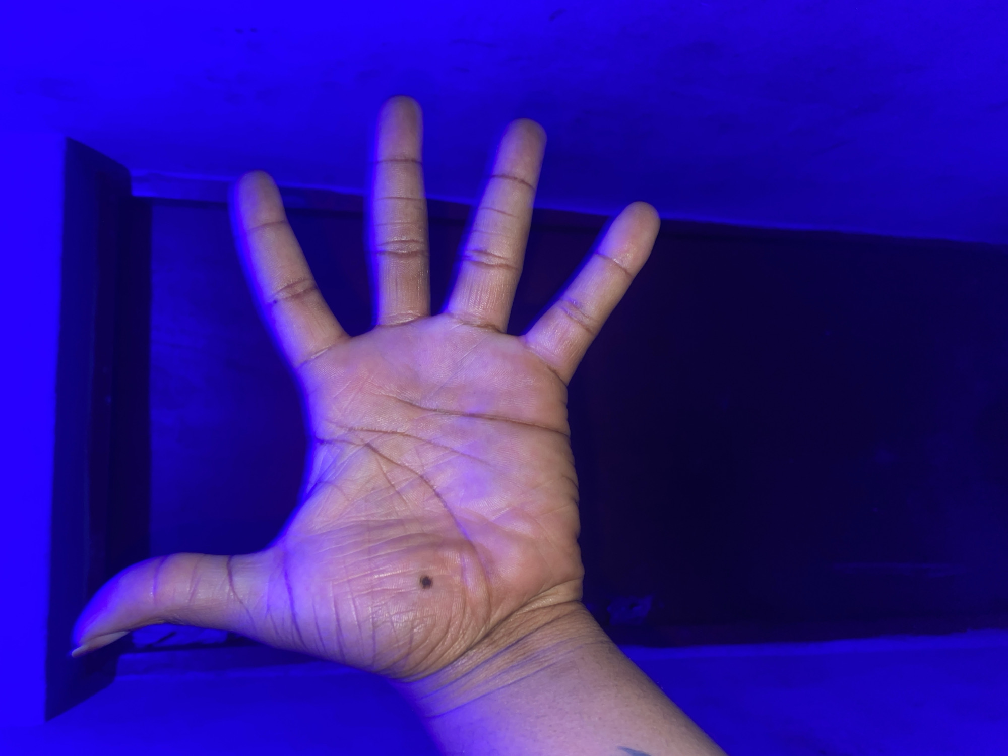 A human hand, palm up, is centered in the frame. The hand is under a blue light. A dark mole is visible on the palm. Fine lines and wrinkles are visible on the hand. A portion of what appears to be a tattoo is visible on the wrist. The background is partially illuminated by the same blue light, revealing dark, undefined objects. There is no indication of the location being Jos, Nigeria.