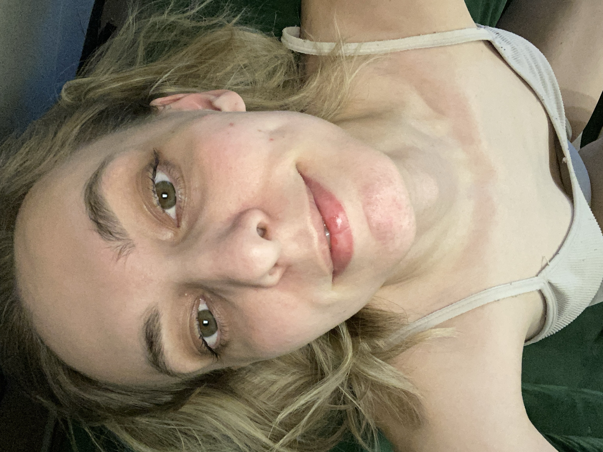 A close-up, tilted selfie features a fair-skinned woman with blonde, shoulder-length curly hair. She has hazel eyes, defined eyebrows, and a small nose with freckles. Her lips are coated with a glossy lip product, and her expression is slightly smiling. She is wearing a light-colored tank top with thin straps. Sunburn marks are visible on her chest and shoulder area, indicating the outline of clothing. The background appears to be a dark green fabric surface, possibly a couch or bedding. There is no information in the image that indicates a location in the city of Chaikovsky, Russia.