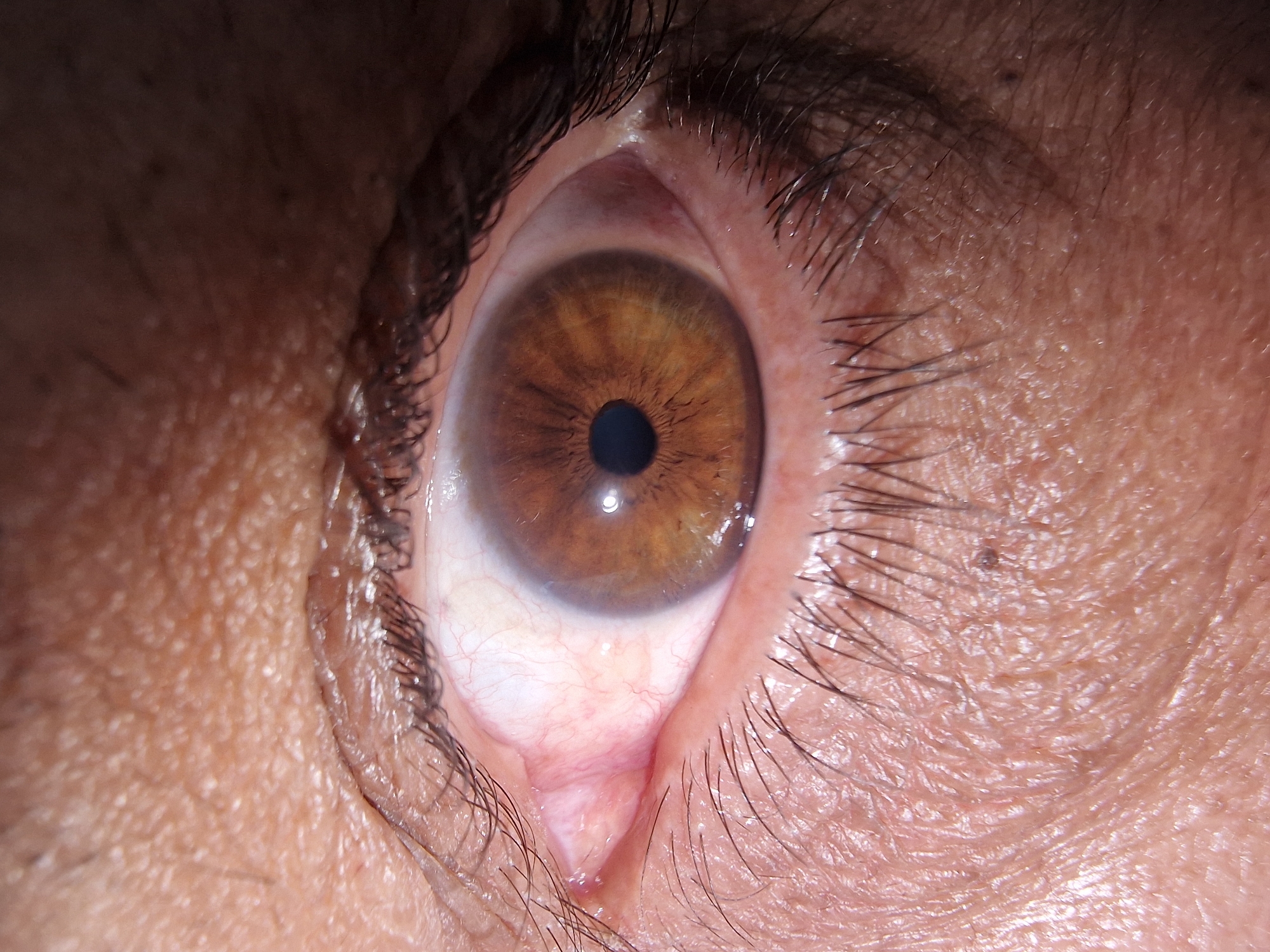 A close-up image shows a human eye with a brown iris and a dark pupil. The surrounding sclera appears white with visible blood vessels. Eyelashes are present on both the upper and lower eyelids. The skin surrounding the eye shows details such as texture and folds. The environment or city is unknown.