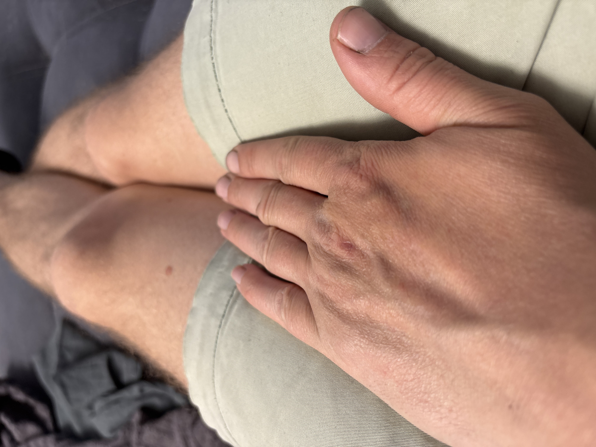 The image, taken from a first-person perspective, displays the lower torso and legs of an individual in a relaxed, seated, or reclined position in Unknown, Unknown. The subject's left hand, with visible veins, minor epidermal irregularities, and short, slightly soiled fingernails, rests on the upper right thigh. The hand is positioned palm-down, fingers extended over the thigh. The individual's bare legs, light-toned with visible hair, extend from beneath light-colored, possibly khaki or light green, ribbed-fabric shorts. A small reddish-brown mole or blemish is visible on the right thigh. The knees are partially visible and slightly bent. In the blurred background, dark grey or dark blue upholstered furniture is present, along with folded dark fabric items in the upper left corner, possibly additional clothing. The scene is illuminated by ambient, diffuse light.