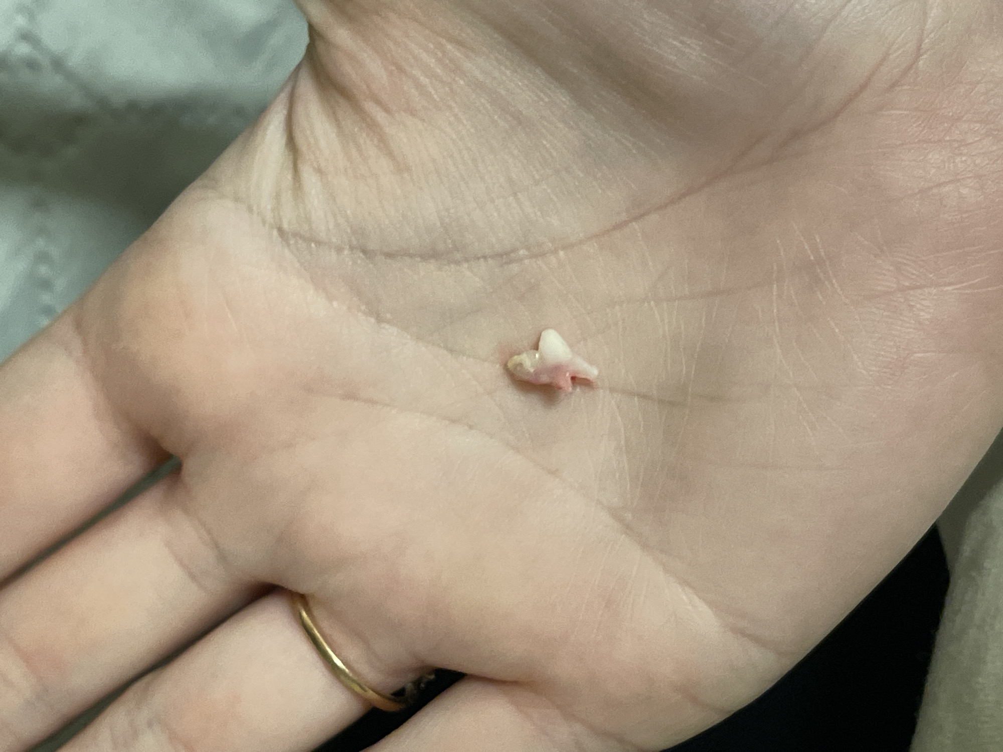 A close-up photograph shows a human hand with a gold ring on the ring finger. Lying in the center of the palm is a tooth with attached tissue. The skin tone of the hand is fair. The background is blurred and out of focus, revealing fabric in shades of gray and black. The photograph does not provide any indication of location, including Sofia, Bulgaria.