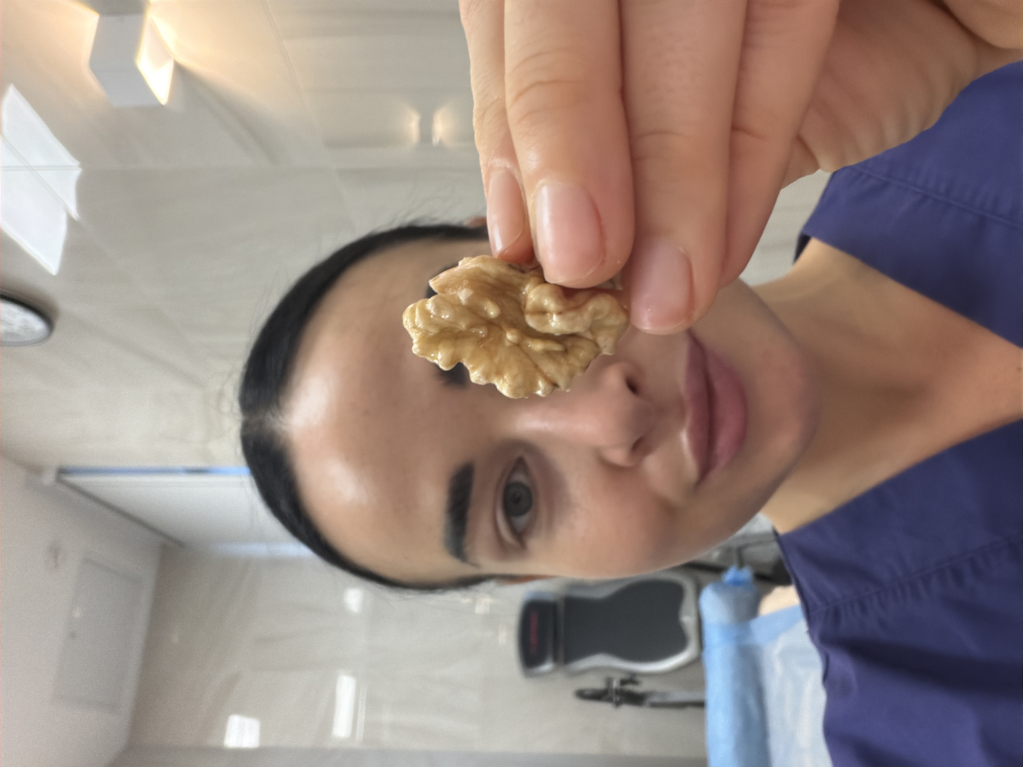 A person with dark hair pulled back and wearing a blue scrub top is holding a shelled walnut in front of their right eye. The background appears to be a medical examination room, with a weight scale visible behind the person, along with medical equipment covered in a blue cloth. The location is likely a medical facility, potentially in the city of Saint Petersburg, Russia, based on the available information and lack of contradicting details.