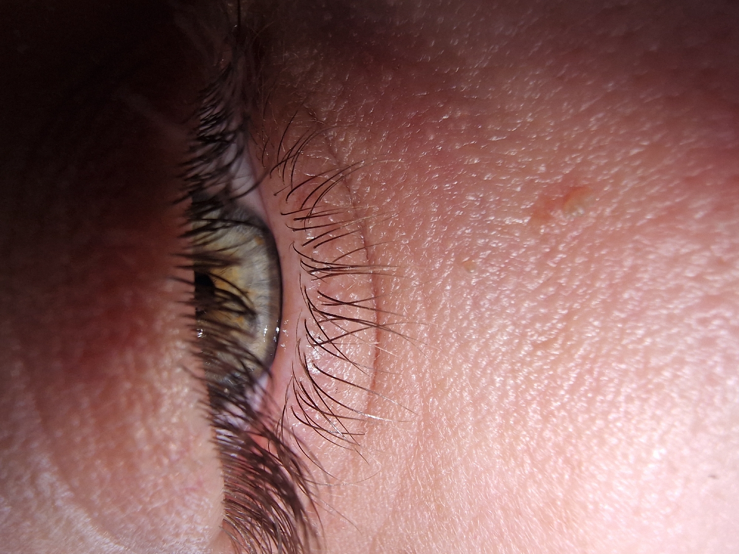 The image is a very close-up, macro photograph of a human eye, likely the right eye, viewed from a low side angle. The eye is open, revealing a light-colored iris, possibly green or hazel, with hints of yellow and brown tones. Prominent, long, and dark eyelashes frame both the upper and lower eyelids, with some moisture or tear film visible along the lower lash line.
The surrounding skin, likely part of the cheek and temple area, is in sharp focus, showcasing intricate details such as pores, fine lines, and subtle variations in texture. A small, slightly raised reddish-orange mark or blemish is discernible on the skin above and to the right of the eye. The overall skin tone is light.
The lighting appears bright, effectively highlighting the fine details of the skin and individual eyelashes. There is no specific activity or event depicted beyond the static presentation of the eye. The background is dark and out of focus, ensuring the eye and its immediate vicinity are the sole focus. There are no visible location cues, time of day indicators, or any text present in the image.