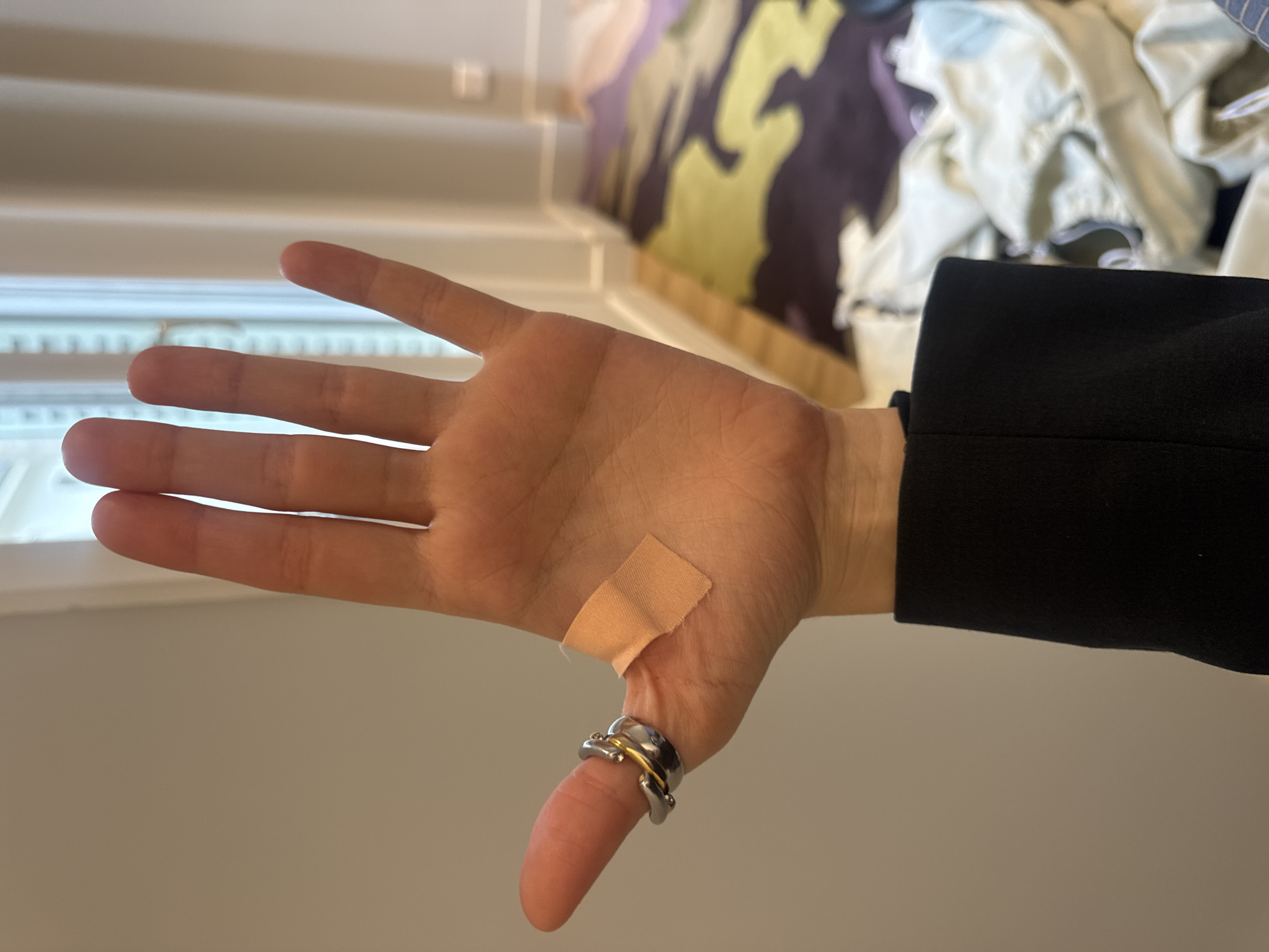 A medium-close, indoor shot features a hand with a bandage on the joint of the thumb. The hand has multiple rings around the thumb joint. The sleeve of a black garment is visible at the wrist. Background includes venetian blinds and a partial view of garments draped behind the hand. No information in the image implies that this image was taken in Paris, France.