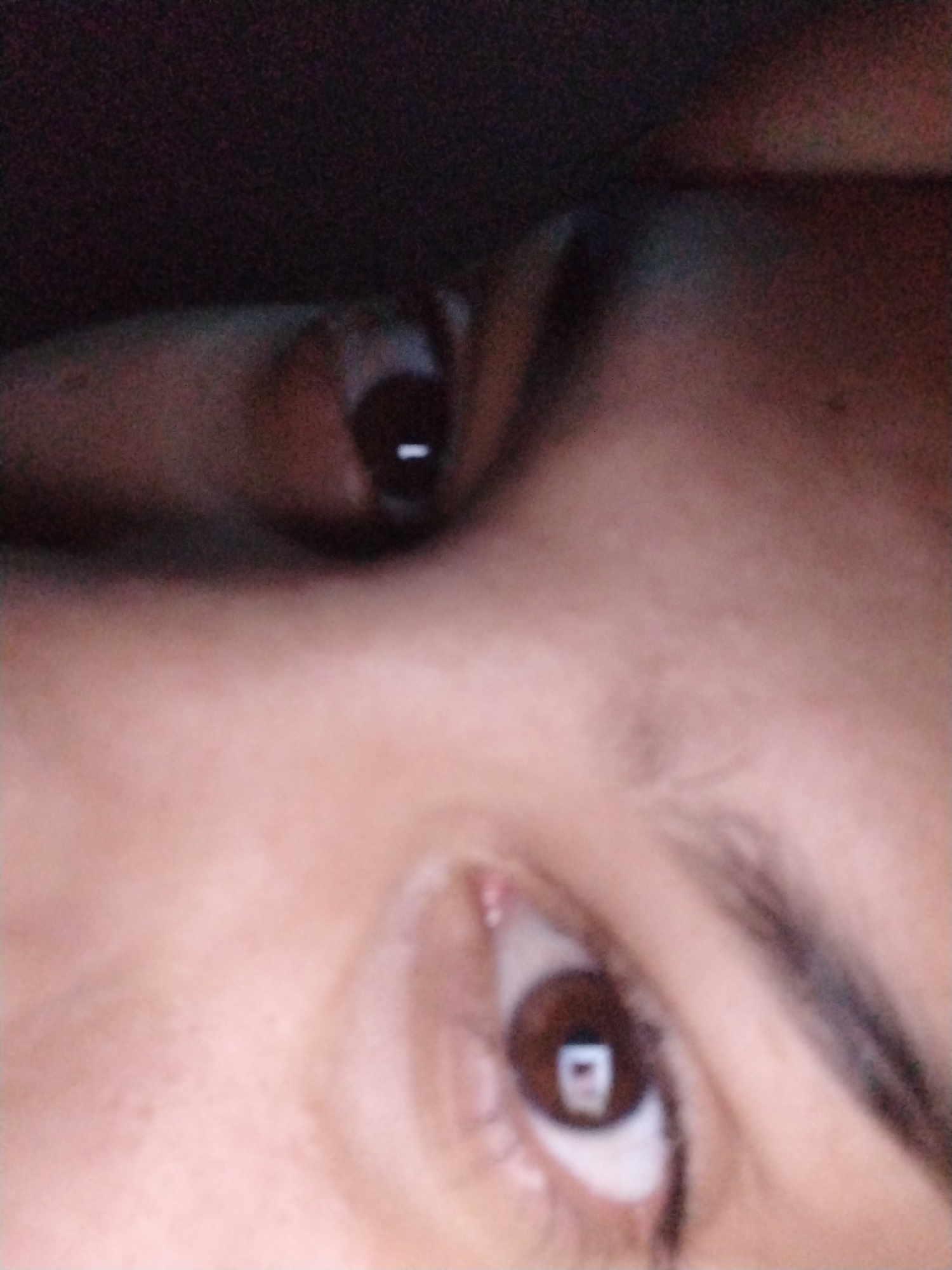 The image shows a close-up of a person's face, specifically their eyes. The upper eye is partially obscured by a dark object or shadow. The lower eye is fully visible, with a brown iris and a visible reflection of a light source. The surrounding skin and eyebrow are also visible. No location or city is discernible from the image.