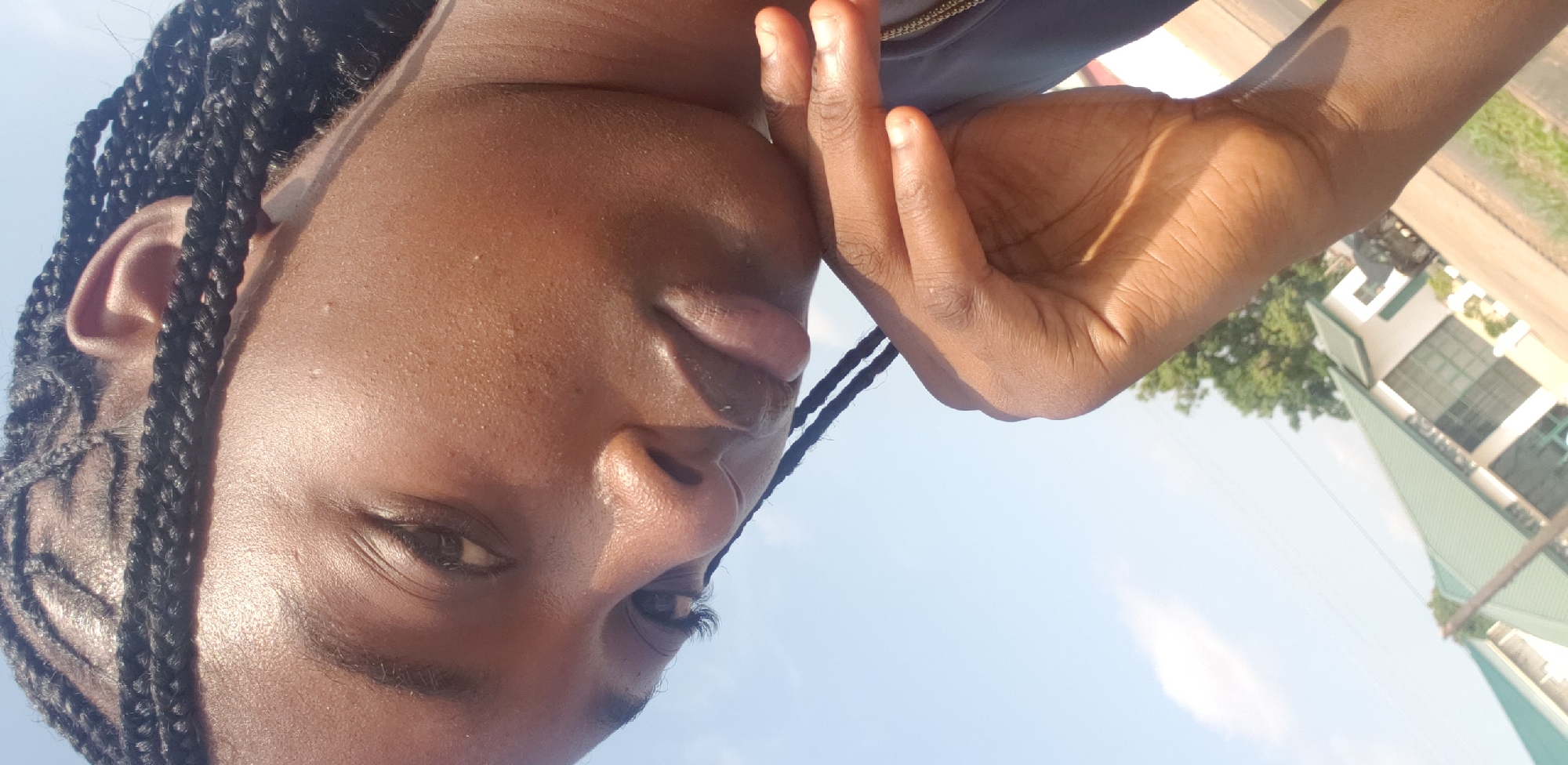 The image is a close-up, rotated portrait of a person with dark skin and numerous small, dark braids, with their head positioned on the left side of the frame and their gaze directed to the right. The person's face is partially visible, showing one eye, the bridge of their nose, and their lips, which appear slightly parted. Strong sunlight creates prominent highlights on their skin, particularly across the forehead, cheek, and lips, indicating a bright outdoor setting. One of the person's hands is raised near the right side of their face.
The individual is wearing a dark garment with a visible zipper on the upper left portion of the image. The background reveals a clear blue sky with scattered white clouds, green foliage from trees, and parts of a building featuring a distinct green, angular roof and white walls. This suggests an outdoor, possibly urban or semi-urban, environment in Barden Yana, Nigeria. The time of day is clearly sunny daylight. No text is visible in the image.