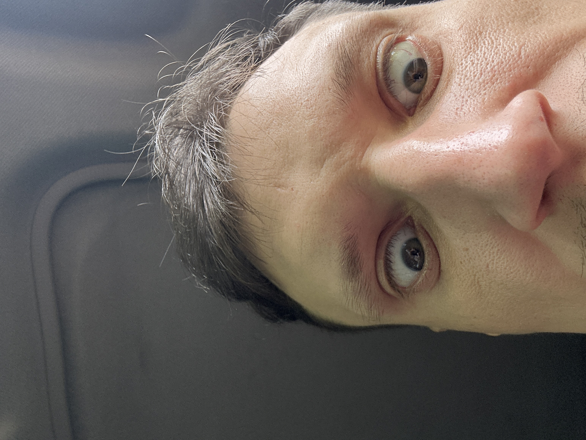 This is a close-up, low-angle selfie of a man's face, specifically his eyes, nose, and forehead. His eyes are wide and looking directly at the camera, with visible pupils and irises. The lighting suggests an indoor environment, possibly a car interior, given the dark, textured surface visible at the top of the image, which resembles a car's sun visor or headliner. The man's skin texture is visible, with some pores and slight shine. His hair is dark with some graying strands, and a few fine hairs are sticking up. There is no indication of the city of Shatava, Ukraine, or any other specific location.