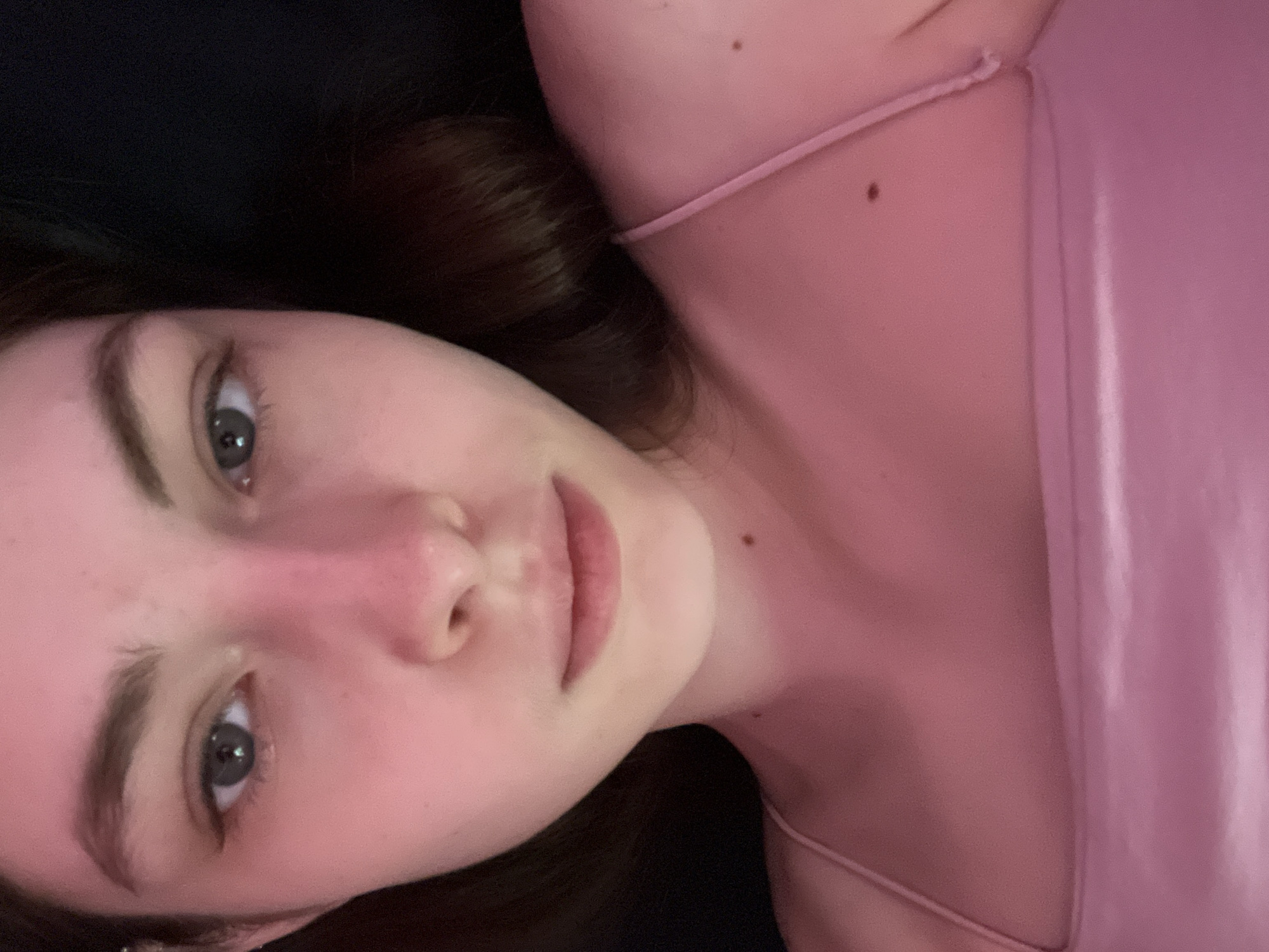 A close-up, vertically oriented photograph depicts a young woman. Her face is the primary subject, positioned towards the left side of the frame. Her eyes, with gray irises, are open and directed towards the camera. Her skin tone appears fair, with some redness on her cheeks and nose. She has dark eyebrows and her lips are closed. A portion of her brown hair is visible near the top and left edges of the image, blending into a dark background. She is wearing a light pink top with thin straps. Two moles are visible, one on her neck and another on her shoulder. The background is primarily black, offering minimal detail. The overall lighting is soft and diffused. There is no evidence to indicate this photograph was taken in the city of Saint Petersburg, Russia.