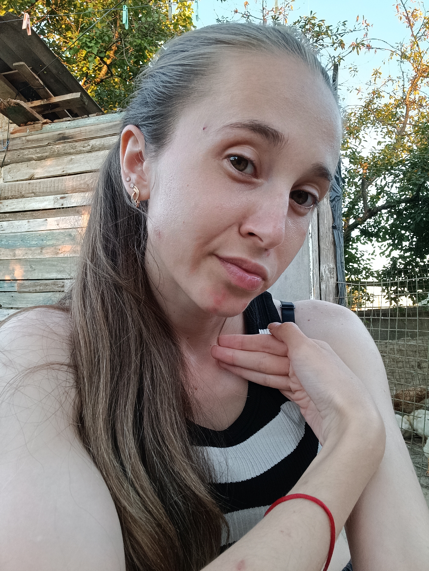 A young woman with long brown hair and fair skin is captured in a close-up, outdoor selfie. She is wearing a black and white striped top and a red bracelet on her left wrist. Her right arm is raised, with her hand resting on her neck and chin, partially obscuring her face. The background appears to be a rustic, rural setting with wooden structures and a wire fence, possibly in the city of Vypasne, Ukraine. There are trees with green foliage and a bright sky visible. The lighting suggests it is either early morning or late afternoon. The woman has multiple piercings in her left ear. There are visible red marks on her neck and chin area.
