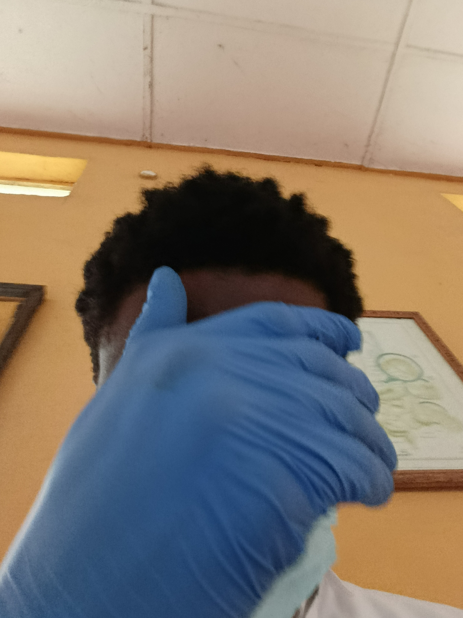 The media file is a close-up, low-angle shot of a person's head, partially obscured by a blue glove. The person has dark, curly hair and their face is mostly hidden. They appear to be wearing a white garment. Behind them, a pale ceiling with visible lines or panels is visible, along with a section of an orange-colored wall. A framed picture or poster with what looks like a diagram or illustration is mounted on the wall, to the right of the person. A hint of another framed object is visible on the far left of the image. The lighting suggests an indoor setting, likely during the daytime due to the brightness. The overall impression is that of a personal, perhaps candid, photograph taken in a room. The location context of Ukpor, Nigeria, provides a geographical setting for this scene.