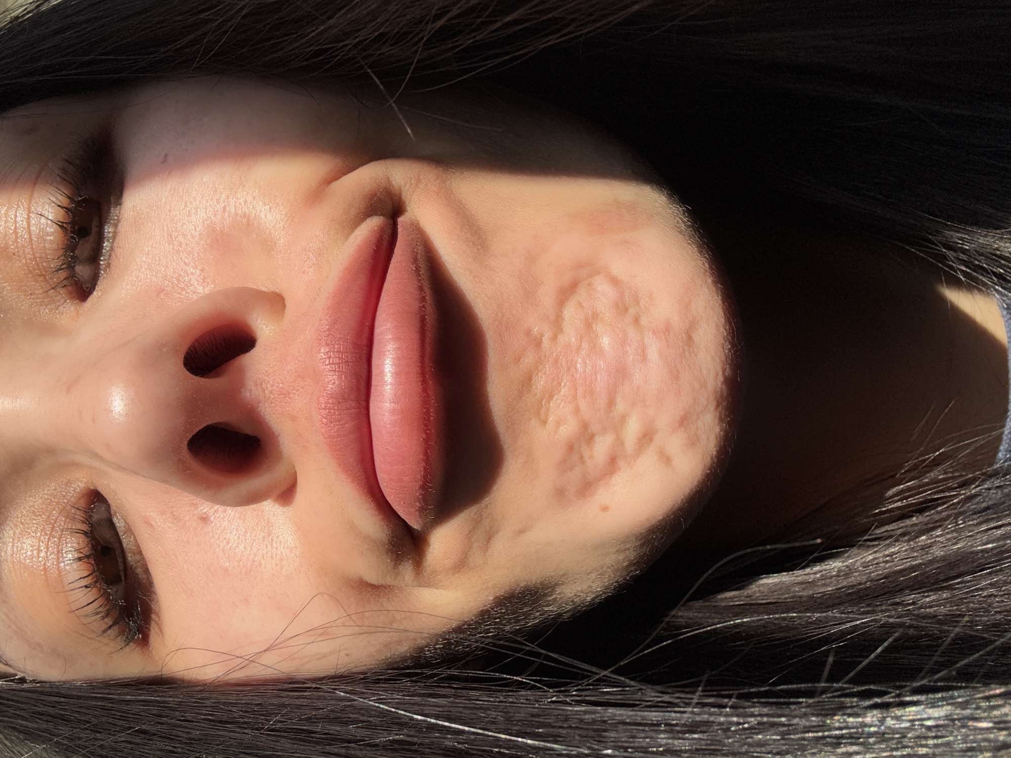 A close-up, overhead shot depicts a person's face, likely female, with dark hair framing the sides. Her eyes are mostly closed, with visible eyelashes. The skin is light-toned, with prominent acne scars on the right cheek. The lips are full and appear slightly pink. Sunlight highlights some areas of the face while casting shadows on others. No indications that this image was taken in Molodezhnyi, Russia, can be determined.