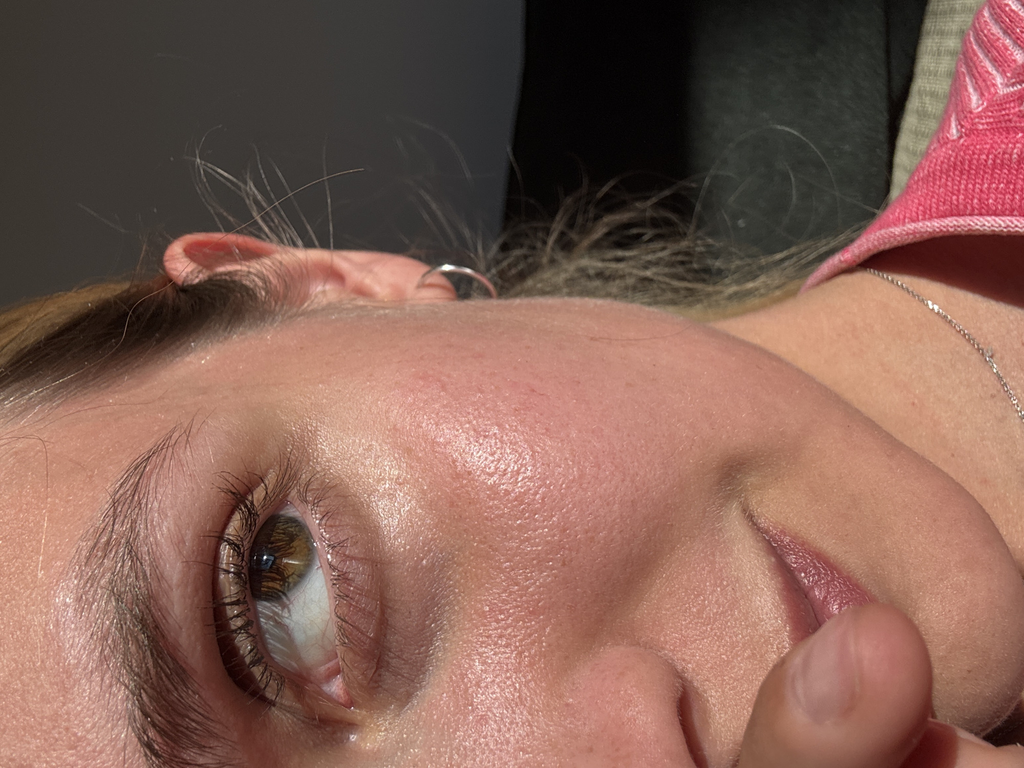 The image is a close-up, angled view of a person's face, primarily focusing on the right eye, forehead, nose, and part of the mouth. The person appears to be lying down or reclining, with their head tilted.
The main subject is a young person, depicted from just above the eyebrow down to the upper lip and chin area. Their right eye is open, revealing a brown iris, visible lashes (which appear long and dark, possibly with mascara), and a clear white sclera. The skin on the forehead and around the eye is smooth with visible pores, catching strong, direct light that highlights its texture and gives it a slightly dewy or oily appearance. Dark, full eyebrows frame the eye.
Above and behind the person's head, parts of their hair, appearing brown or blonde, are visible, along with a portion of an ear. A silver ring is noticeable near the ear. To the right of the frame, a segment of a pink, possibly knitted garment with white linear patterns is visible, along with a silver chain necklace resting against the neck/collarbone area. A finger is gently touching or resting near the person's mouth, which has a natural pinkish-mauve tint on the lips.
The strong, directional lighting suggests either bright sunlight streaming in from a window or a powerful artificial light source, creating distinct highlights and shadows. The background is dark and out of focus, offering no specific location cues. The overall impression is one of a calm or contemplative moment, with the person appearing relaxed. No visible text is present in the image.