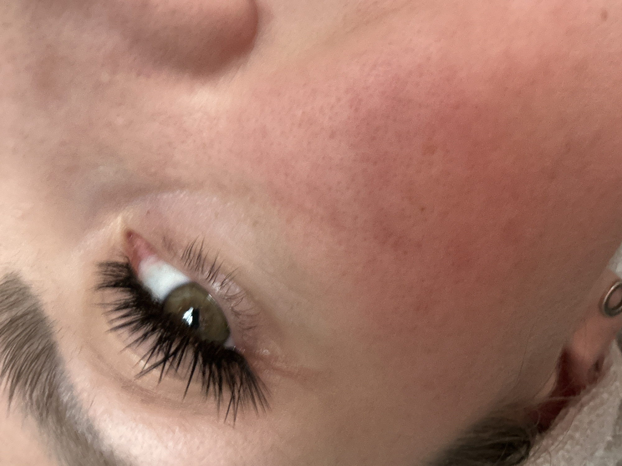 A close-up, high-angle shot focuses on the right eye and cheek of a person. The person has green eyes, dark eyelashes, and light eyebrows. The skin on the cheek appears slightly red and has visible pores and some freckles. The image is taken indoors and there is no indication of the city of Novoaltaysk, Russia, or any other location.