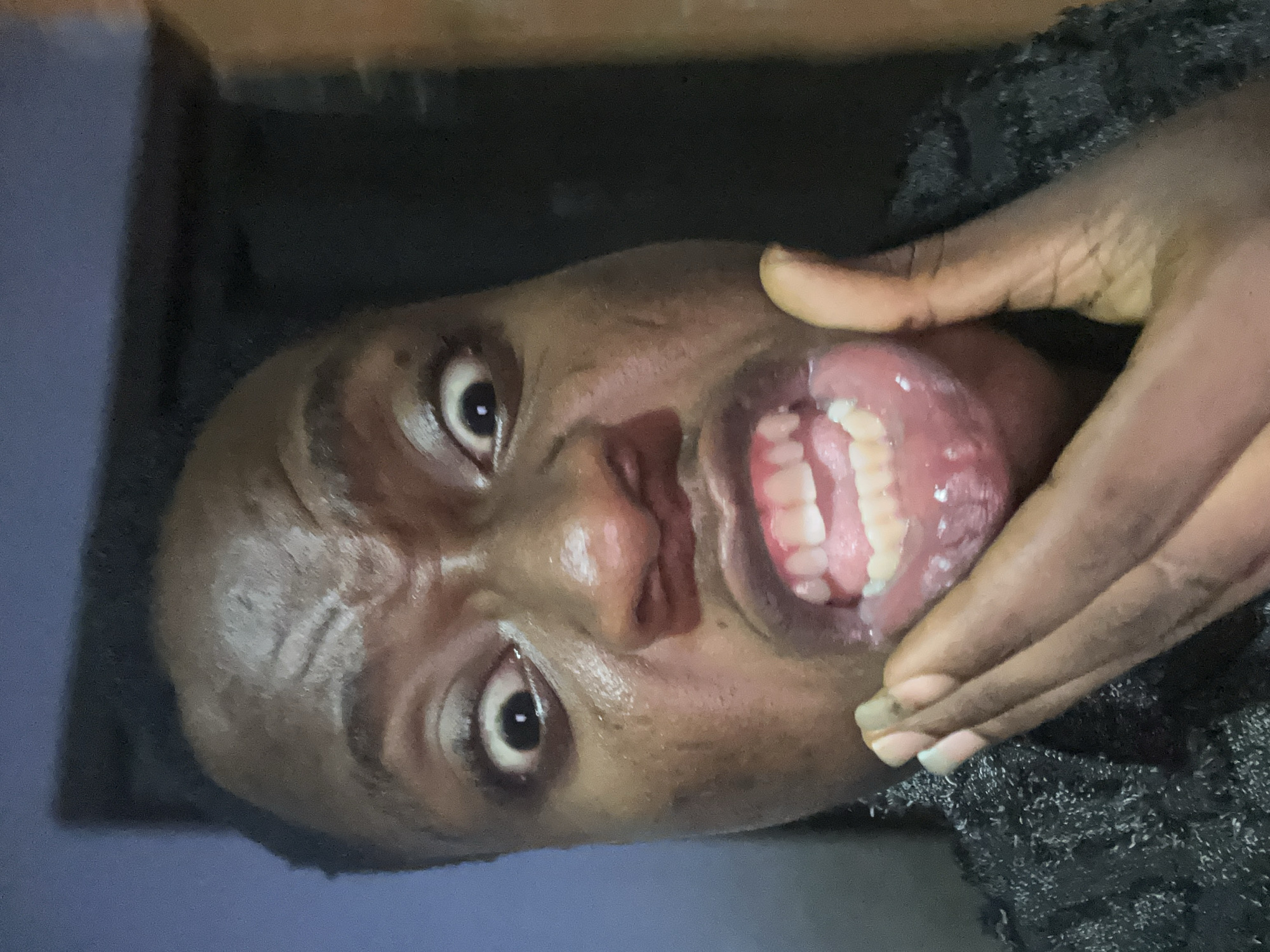 A close-up image shows a person with dark skin, eyes wide open, and mouth stretched open with a hand pulling down on their lower jaw. The person is wearing a dark-colored shirt or top. The background is dark and out of focus, with a hint of blue in the upper left corner.