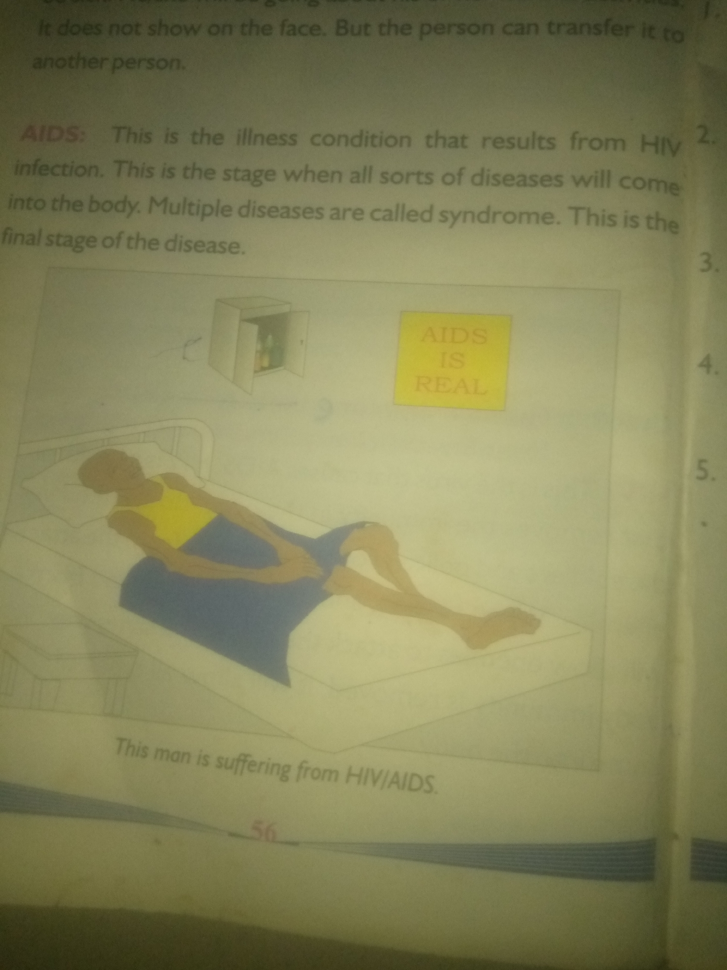 The image is a page from a book, likely an educational text, with an illustration and accompanying text.
The text at the top of the page reads: "It does not show on the face. But the person can transfer it to another person."
Below this, a section is titled "AIDS:" and defines it as "This is the illness condition that results from HIV infection. This is the stage when all sorts of diseases will come into the body. Multiple diseases are called syndrome. This is the final stage of the disease."
To the right of this text, a yellow square contains the words "AIDS IS REAL" in red text.
The illustration shows a person lying in a hospital bed, covered by a blue blanket, wearing a yellow tank top. The person appears frail and their body is depicted in a simplified, almost skeletal manner. Next to the bed, there is a small table. In the background, a cabinet with its doors open reveals several bottles.
At the bottom of the page, a caption reads: "This man is suffering from HIV/AIDS." A page number "56" is visible below this caption.
The image is a flat, 2D representation, typical of textbook illustrations. There is no information that can be used to determine its location in the city of Unknown, Unknown.