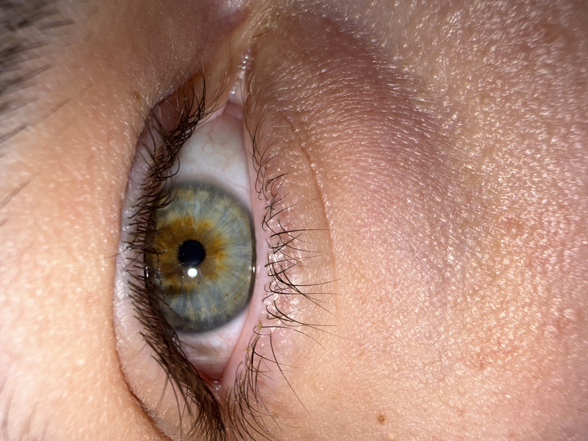 The image is a close-up of a human eye. The iris is a hazel color with a mix of brown, green, and blue. The pupil is black. The surrounding skin is pale and textured. The eyelashes are dark brown. There is no information in the image to indicate a location in Stara Zagora, Bulgaria.
