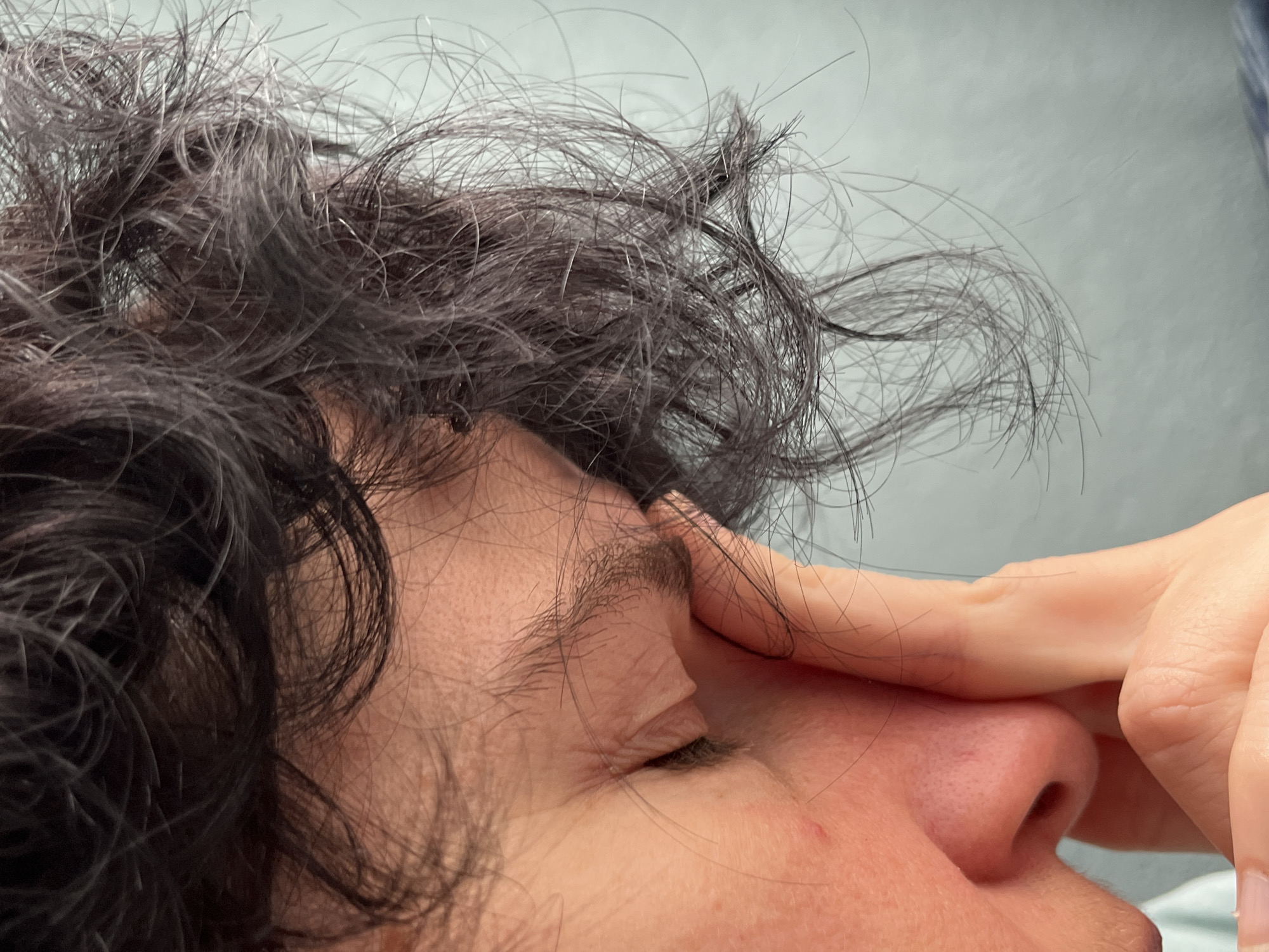 A close-up, side profile shot focuses on a person's face, particularly their eye and nose area, as they rub their forehead with their fingers. The person has dark, curly hair that partially obscures their face. The skin appears to have some texture and slight redness around the nose. The background is a soft, pale blue. The image does not contain any information about the location in the city of ღრმაღელის თემი, Georgia.