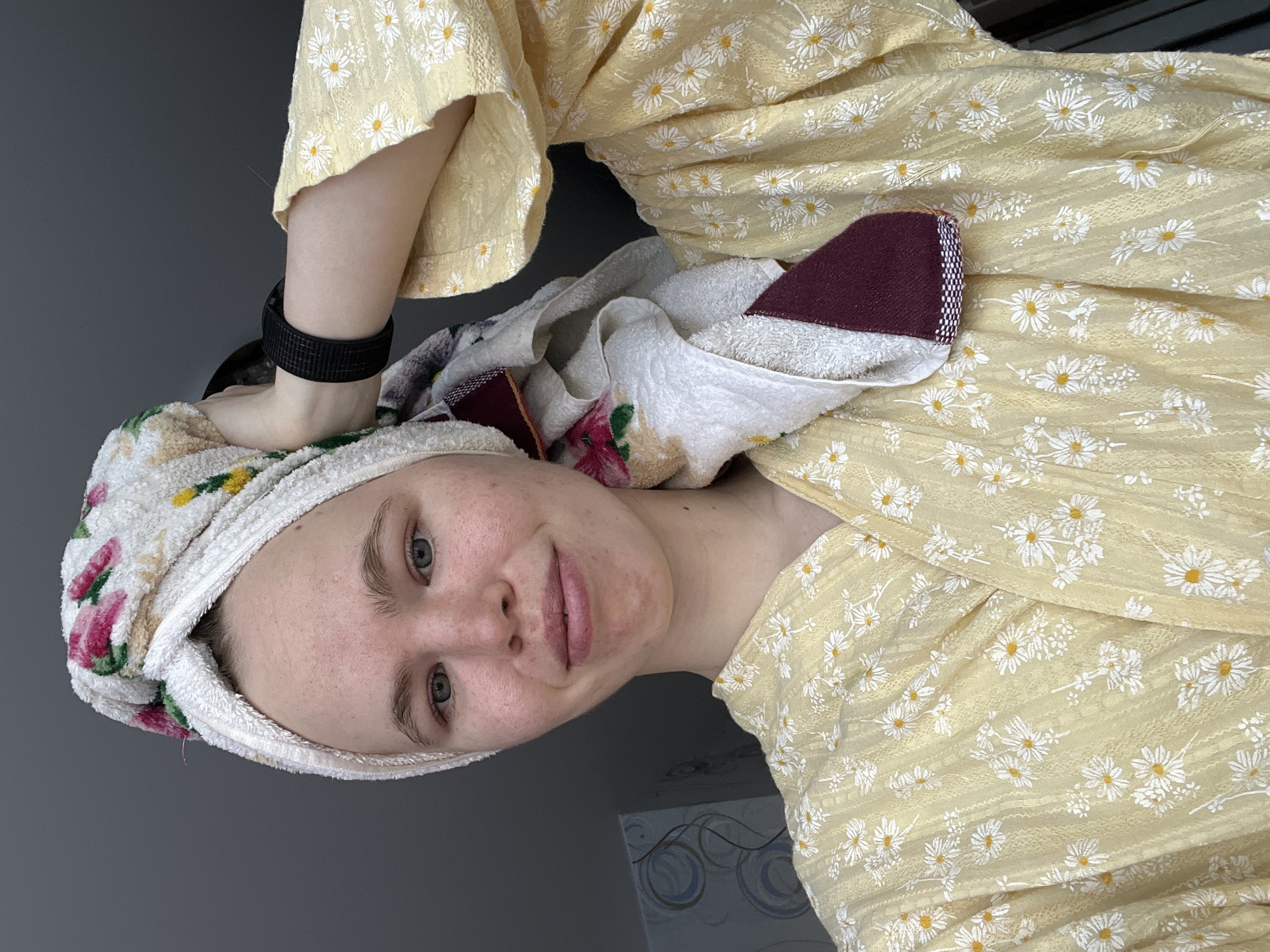 An individual is depicted in a close-up, chest-up selfie format, located in Chaikovsky, Russia. The subject is a fair-skinned person with light hair secured by a white terrycloth towel wrapped around their head in a turban style. The towel features a floral pattern of pink and green with yellow accents. A maroon-colored towel with a patterned edge is also visible, tucked into the main head towel. The individual's face shows some redness and minor blemishes, with light eyebrows and blue-green eyes looking directly at the camera. A slight, closed-mouth smile is present. The subject is wearing a light yellow bathrobe adorned with a white daisy floral pattern, featuring yellow centers. A black, textured wristband is visible on the subject's left wrist. The left hand is positioned near the left side of the head, appearing to support or adjust the towel. The background behind the subject is predominantly a solid, dark gray, with a small section on the left revealing a lighter, possibly textured or patterned wall featuring circular motifs.