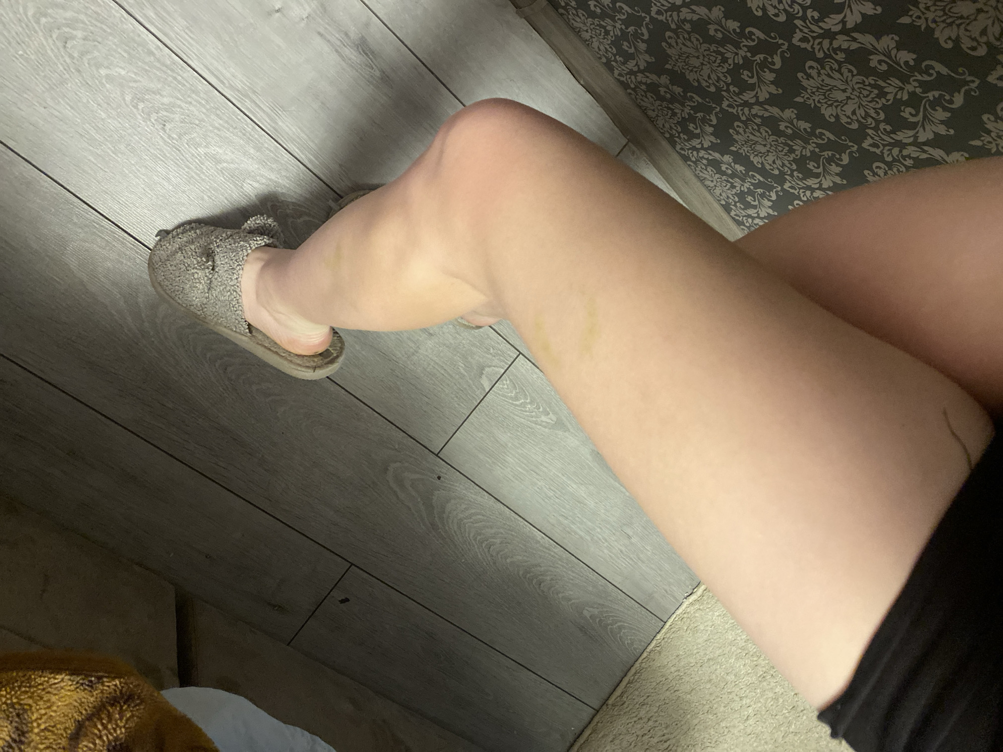 A person's leg is shown, positioned on gray wood-look flooring next to patterned wallpaper. The leg has a small bruise on the shin and is wearing a fluffy slipper on the foot. A portion of a black garment is visible near the thigh. A fluffy brown object is in the lower left corner of the frame. The location is not discernible as being in Ternopil, Ukraine based on the image.