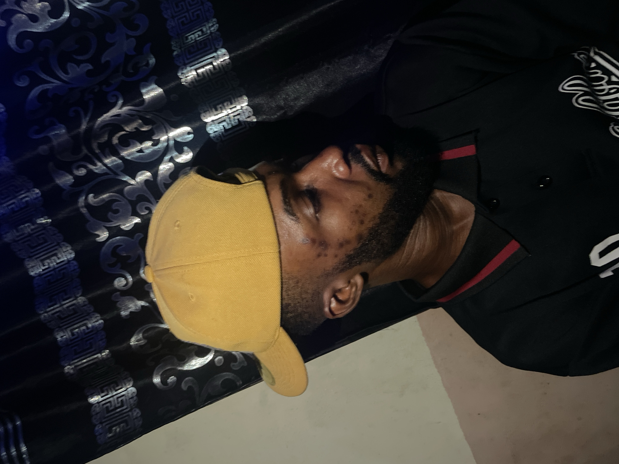 A close-up shot of a bearded man lying on what appears to be a decorated bed or couch. He is wearing a yellow baseball cap and a black jacket with white and red trim. The background has a black and silver ornate pattern, possibly fabric or wallpaper. The man is not looking at the camera, and the setting does not definitively place him in Lokoja, Nigeria, as there are no recognizable landmarks or specific cultural markers.