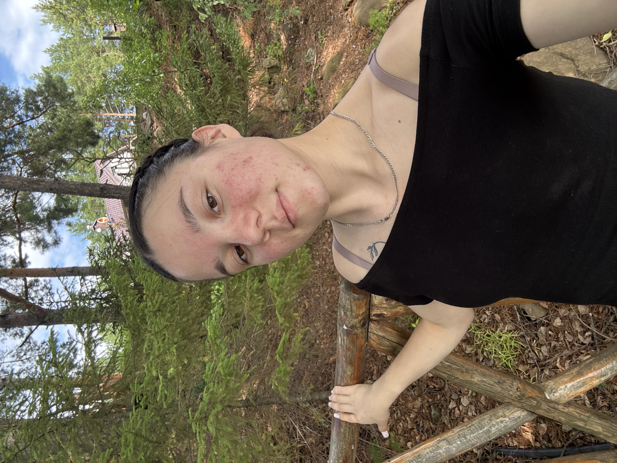 The image shows a young woman outdoors in a wooded area. She is in a vertical orientation, and appears to be taking a selfie. She is wearing a black top with a light-colored bra strap visible. She has a silver chain necklace and a small tattoo on her shoulder. Her face is close to the camera, and her skin has some redness and blemishes. She is looking towards the camera with a neutral expression.
The background consists of trees, branches, and dry leaves on the ground, suggesting a natural, possibly forest-like setting. There is a wooden railing in the foreground that she is leaning on or near. The lighting suggests it is daytime. The scene is consistent with a location in Pozdyshki, Russia, given the presence of coniferous trees and a rustic outdoor environment. There is no visible text in the image.