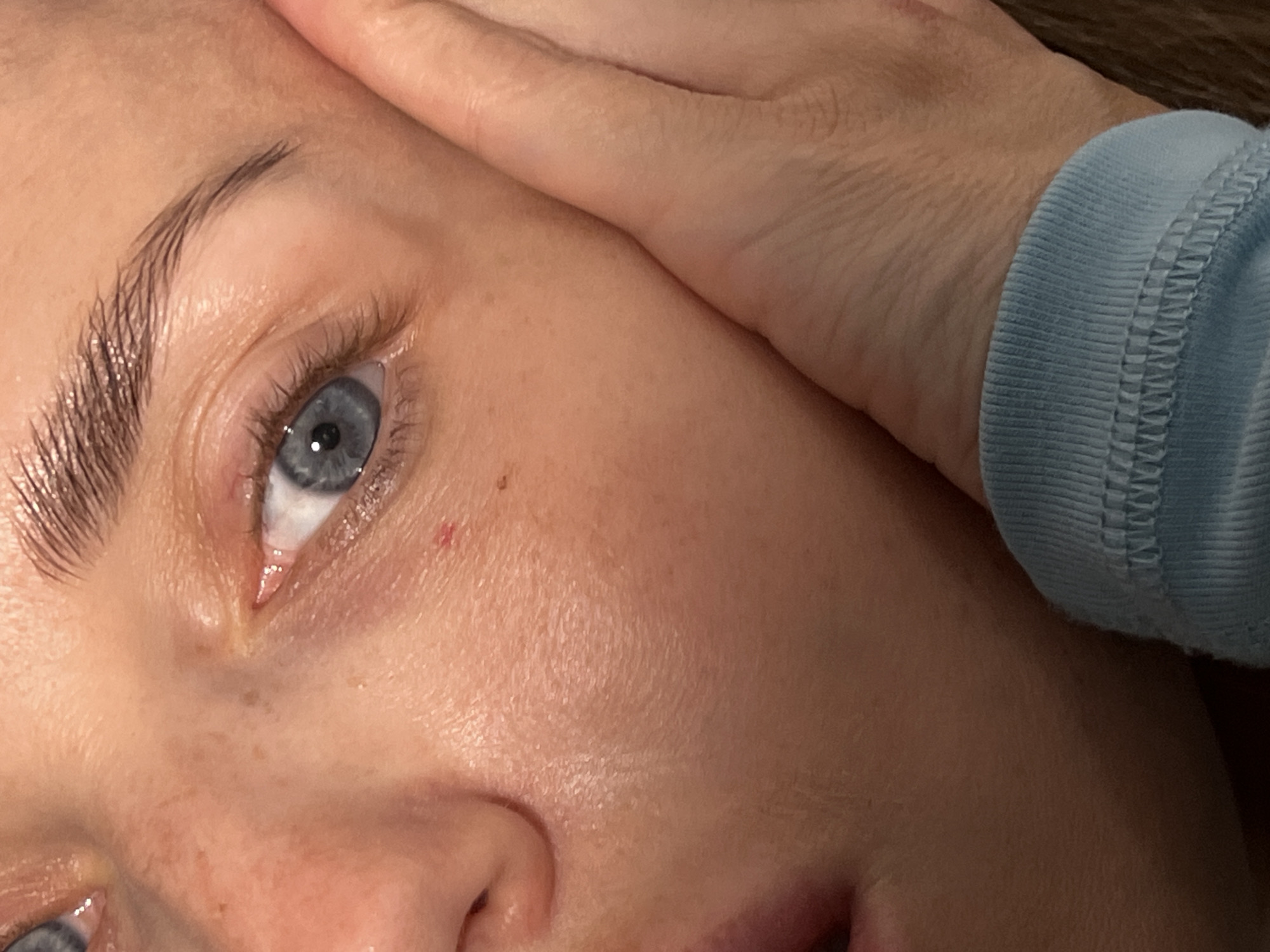 The image is a close-up of a person's face, focusing on their left eye, eyebrow, and cheek. A hand is gently resting on the cheek, obscuring part of the face. The person has blue eyes and fair skin with some freckles. There is a small red mark on the cheekbone near the eye, possibly a beauty mark or a small blemish. The background is out of focus, but appears to be a light-colored wall or surface. The overall lighting suggests an indoor setting, possibly a home. There is no information in the image to suggest a location in the city of Unknown, Russia.