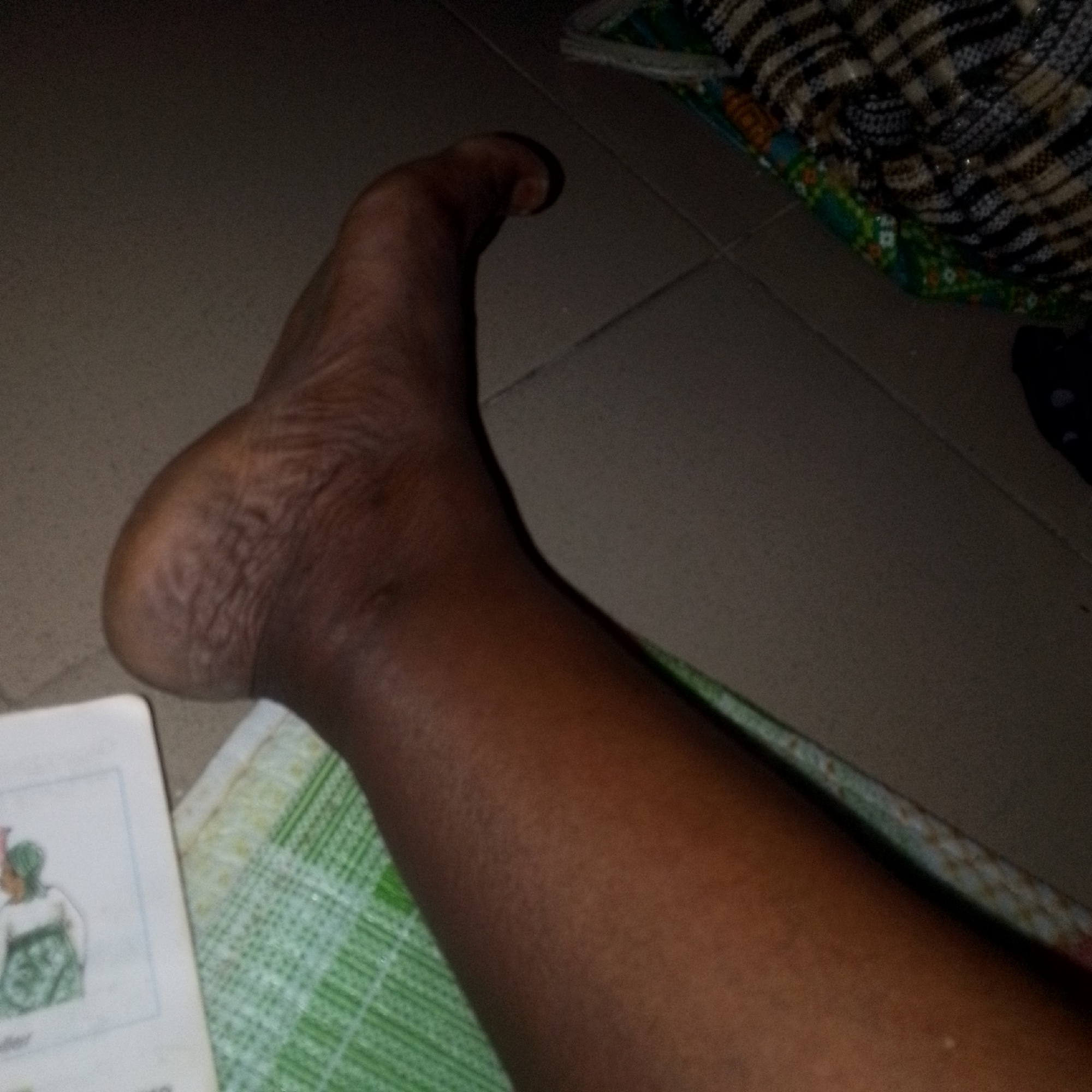 A close-up image shows the right foot and lower leg of a person with dark skin. The foot is positioned in the center of the frame, with the heel towards the left and the toes extending towards the upper right. The skin on the heel is dry and appears to have wrinkles or cracks. The rest of the visible skin on the leg is smooth. The foot and leg are resting on a green and white checkered fabric. To the left of the foot, a portion of a book or pamphlet is visible, featuring an illustration of two people. The background is dark and appears to be a tiled floor, with a patterned blanket or rug draped in the upper right portion of the image. The lighting is dim.