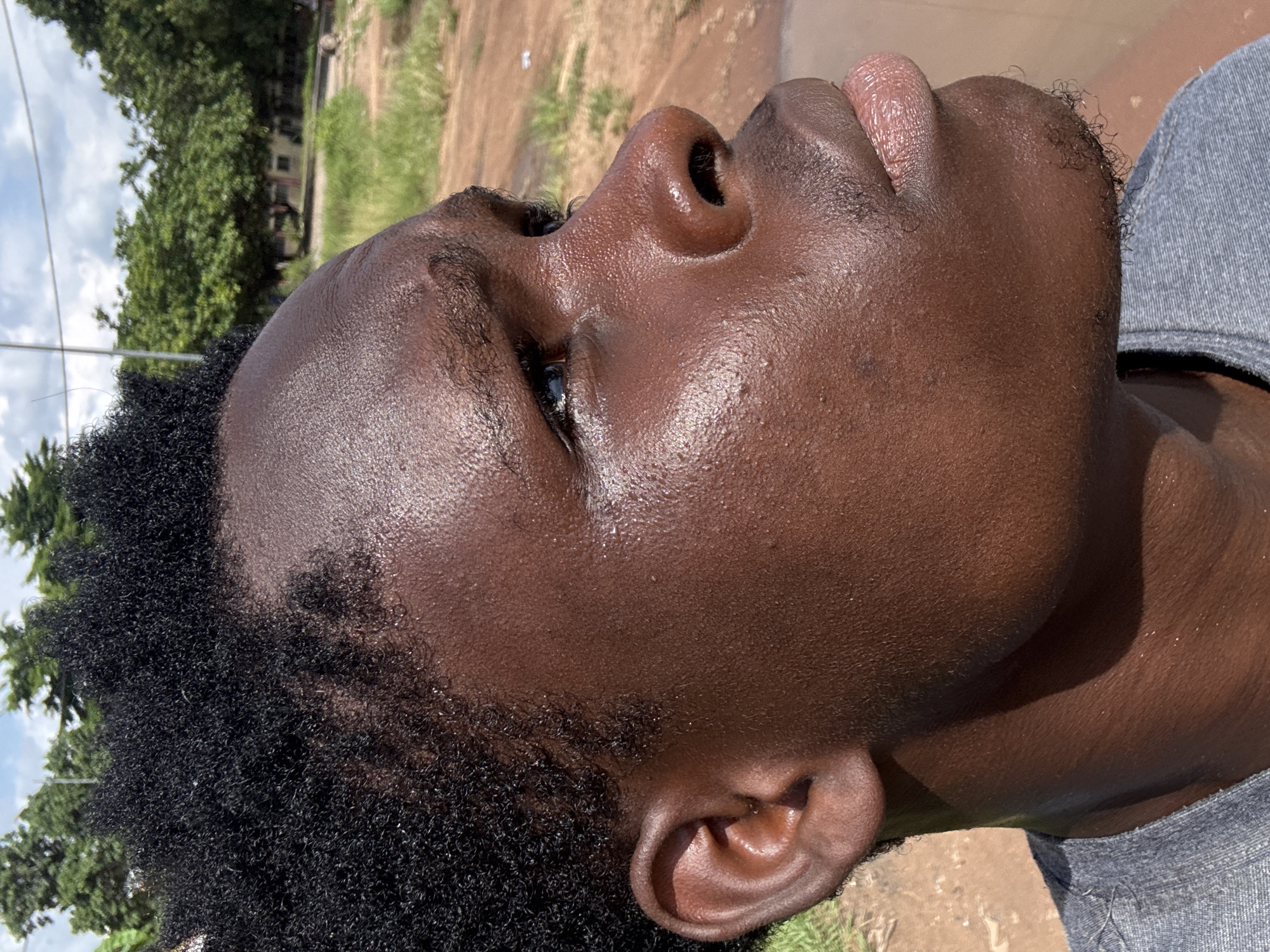 A close-up, rotated profile shot captures the right side of a young person's face, looking upwards and slightly to the left. The individual has dark skin, which appears somewhat shiny, possibly from sweat or oil, with visible pores. They have short, dark, curly hair and some stubble on their chin and jawline. Their right eye is partially visible, looking upward, and their lips are slightly parted. The person's right ear is also clearly seen.
The background is out of focus but provides context for an outdoor setting in Ihiagwa, Nigeria. It features a bright, partly cloudy sky, numerous green trees, and patches of dirt and grass. Distant, indistinct buildings are visible through the foliage, along with a thin utility line. The bright, direct natural light indicates it is daytime, likely a sunny period. The person appears to be wearing a light blue or grey denim garment on their shoulder. No specific activity is depicted, and the person's expression is neutral or contemplative. No text is visible in the image.