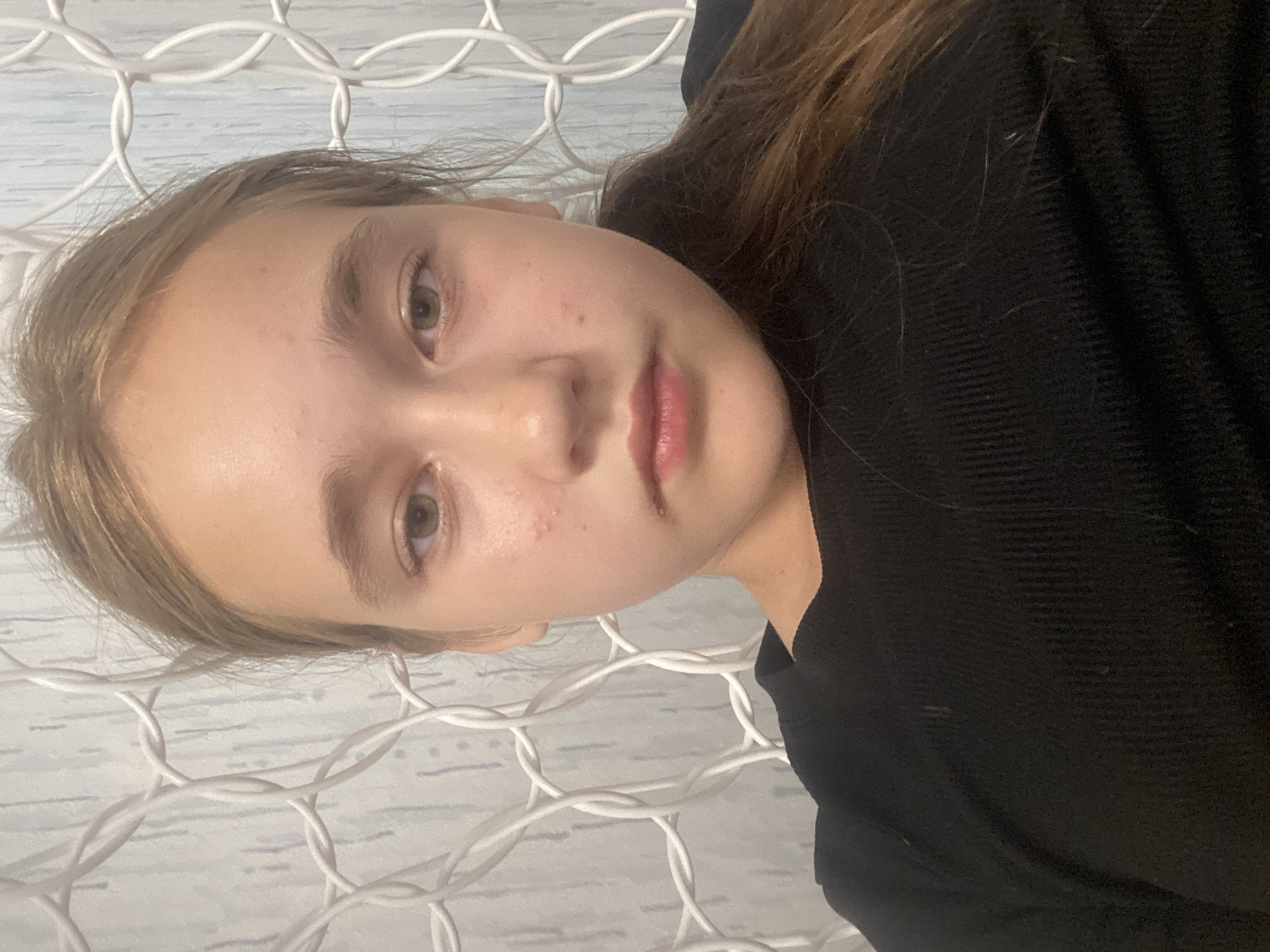 A young girl with light brown hair pulled back to her right is shown in a close-up, head-and-shoulders shot, facing forward and slightly down. She has fair skin, light brown eyes, and appears to have some minor blemishes on her cheeks and forehead. She is wearing a black, ribbed, long-sleeved top. Behind her, a white, woven material with a circular pattern is visible. The setting is indoors, possibly in a home, and no specific details placing it within the city of Vysokiy, Russia, are apparent in the image.