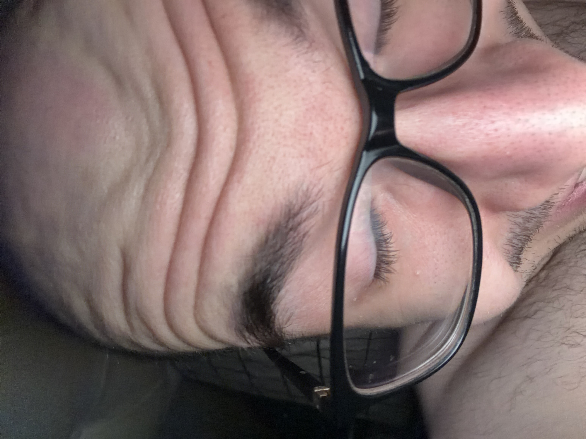 A close-up, angled view of a person's face wearing black-rimmed glasses. The person's eyes are closed. Skin wrinkles are visible on the forehead. Stubbled facial hair is visible, extending to the cheek and jawline. Body hair is visible near the neck. The eyeglasses frame appears to be made of plastic. No details suggest the location is Khimki, Russia.