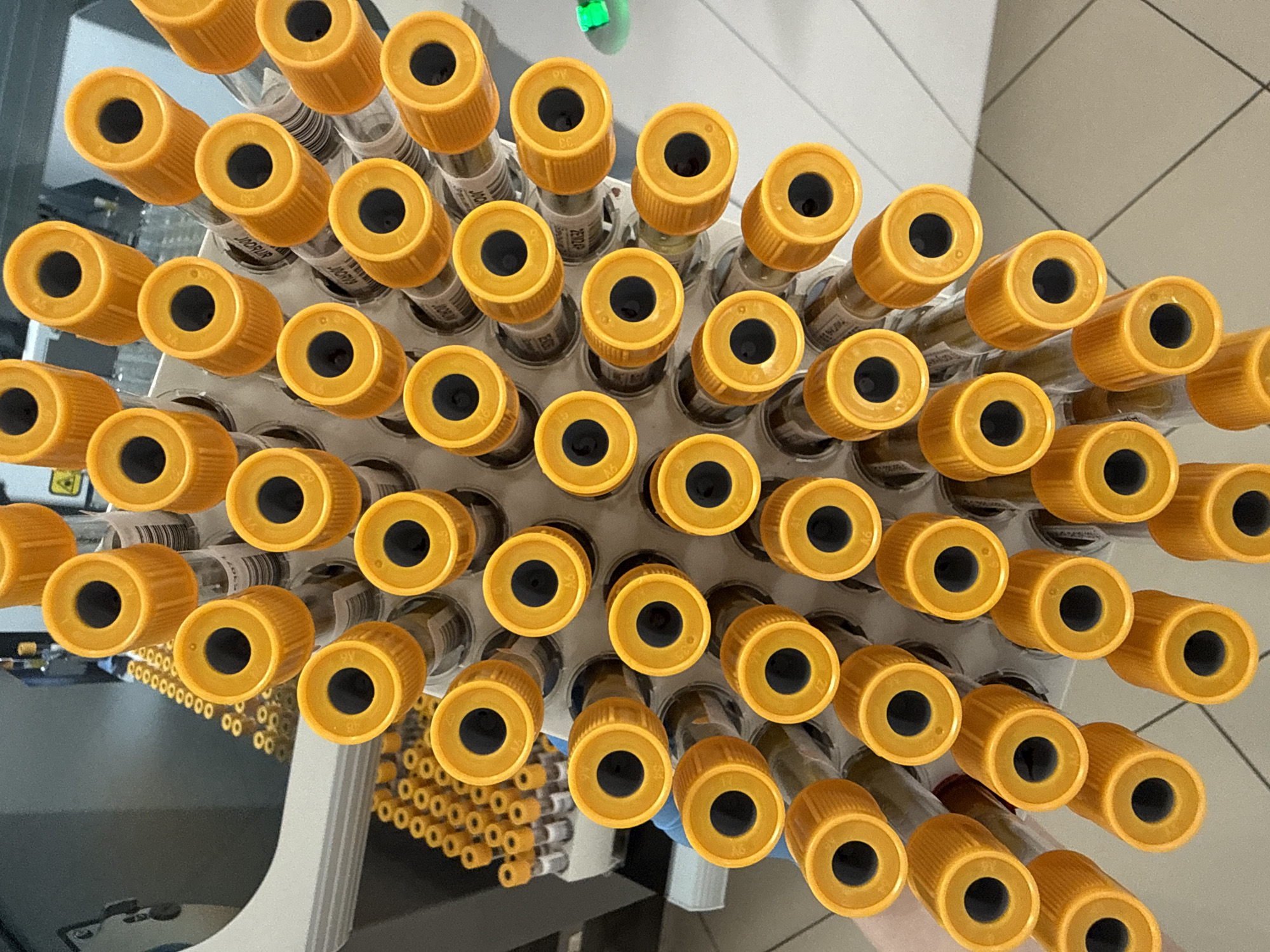 The image shows an overhead view of a rack filled with numerous blood collection tubes, each capped with a yellow stopper. The tubes are likely located in a medical laboratory. There's no information suggesting the location is in Moscow, Russia.