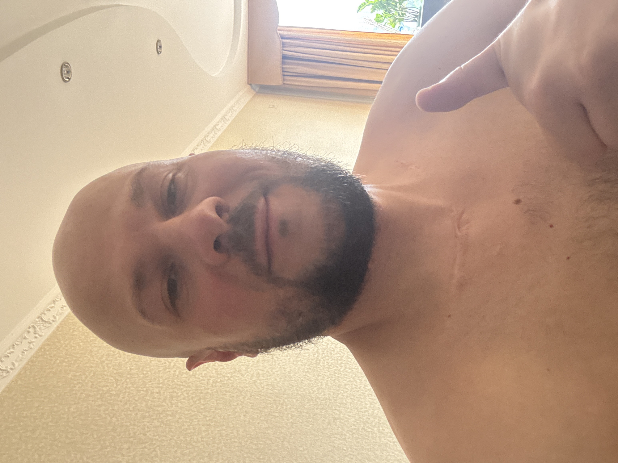 A head-and-shoulders selfie shows a bald, white male with a beard, giving a thumbs-up. He is shirtless, revealing a scar on his neck. The background is a wall and ceiling with ornate molding. The image is a close-up and does not provide information about the location within Almaty, Kazakhstan.