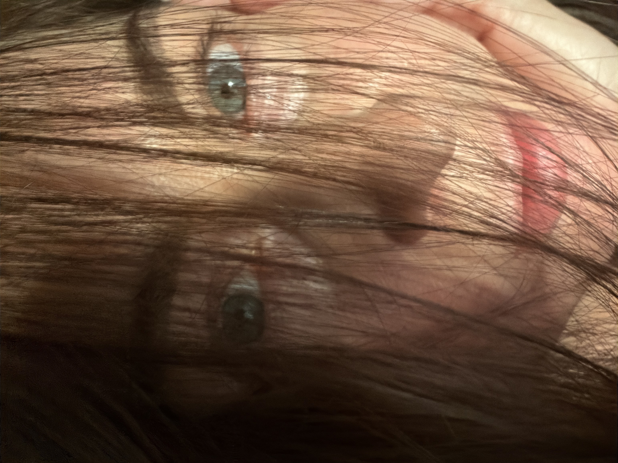 The image shows a close-up of a person's face partially obscured by brown hair. The person has fair skin and blue eyes. A finger is visible near the top of the image, suggesting the person may be holding the hair back. The overall scene is dimly lit. The image does not show anything that connects it to the city of Dubovaya, Russia.