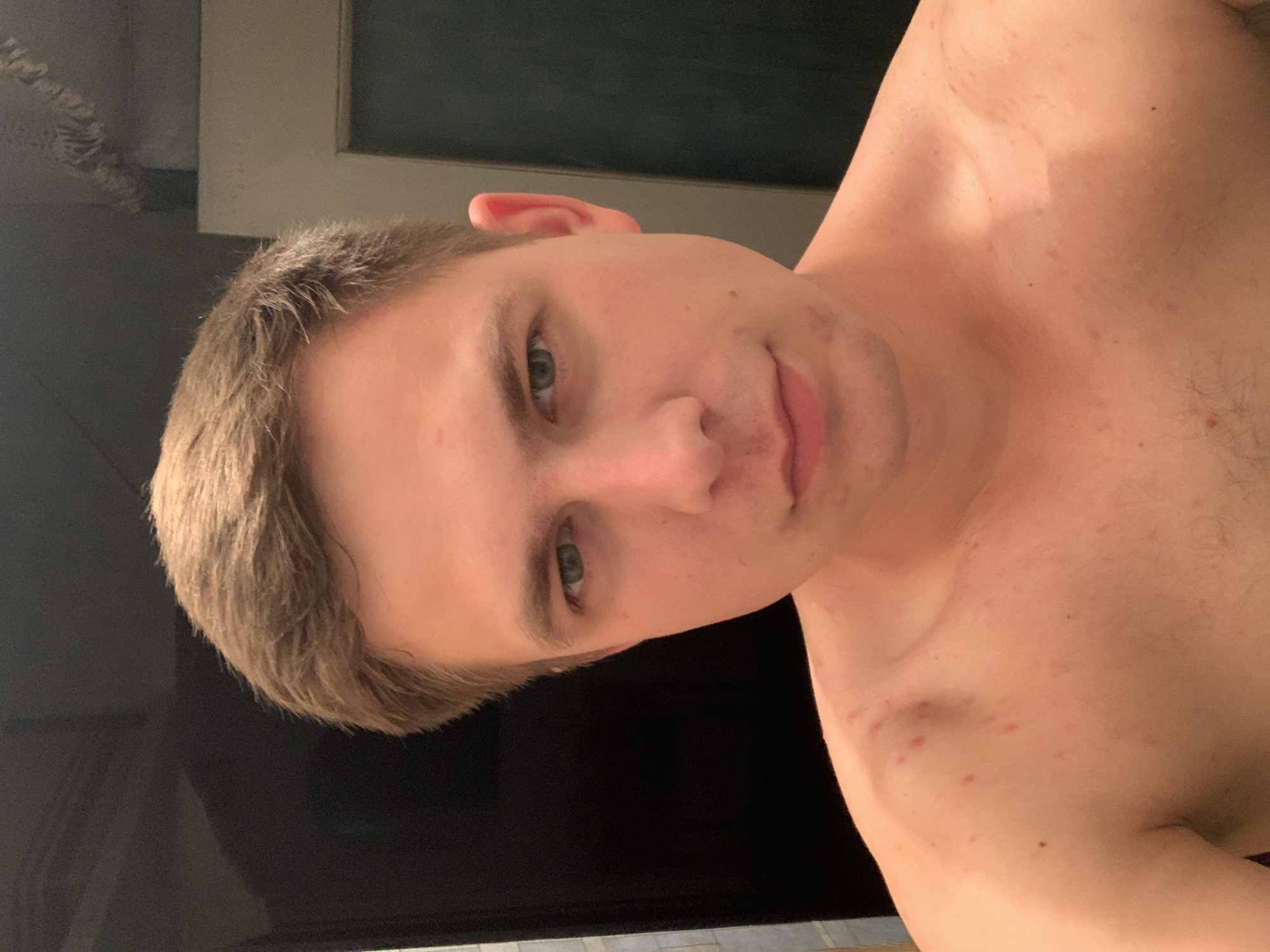 An overhead, close-up, chest-up shot shows a young white man with short brown hair and green eyes. He has a light complexion with scattered red blemishes on his face and chest. He is not wearing a shirt. He is looking directly at the camera. The background is dark and out of focus, with a hint of a door and a towel rack visible on the right.