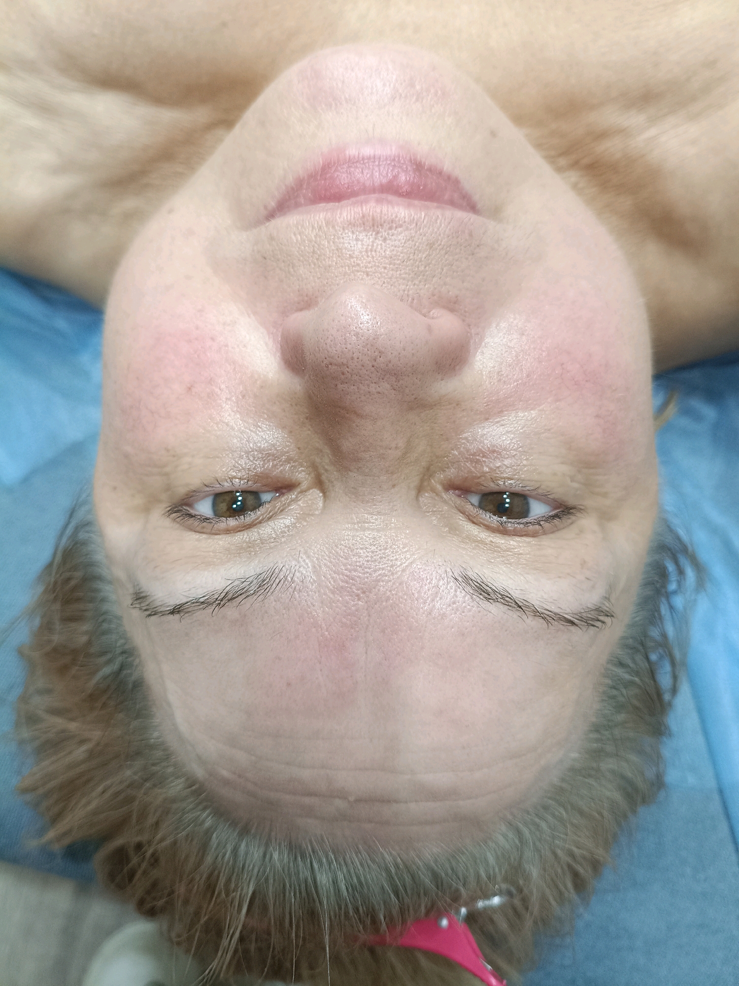 An upside-down, close-up, eye-level shot captures a person lying on a blue medical sheet. The individual, whose face is turned towards the camera, has fair skin and light brown eyes. Their lips are slightly parted and appear pink. Fine wrinkles are visible on their forehead, and their eyebrows are dark and defined. The person's hair is short, a mix of brown and gray strands, framing their face. The background is a soft, blurred light brown color, suggesting a person's shoulder or neck. The overall lighting is even, with a slight sheen on the skin, hinting at moisture. There are no discernible environmental features that would indicate a specific location in the city of Asbest, Russia.