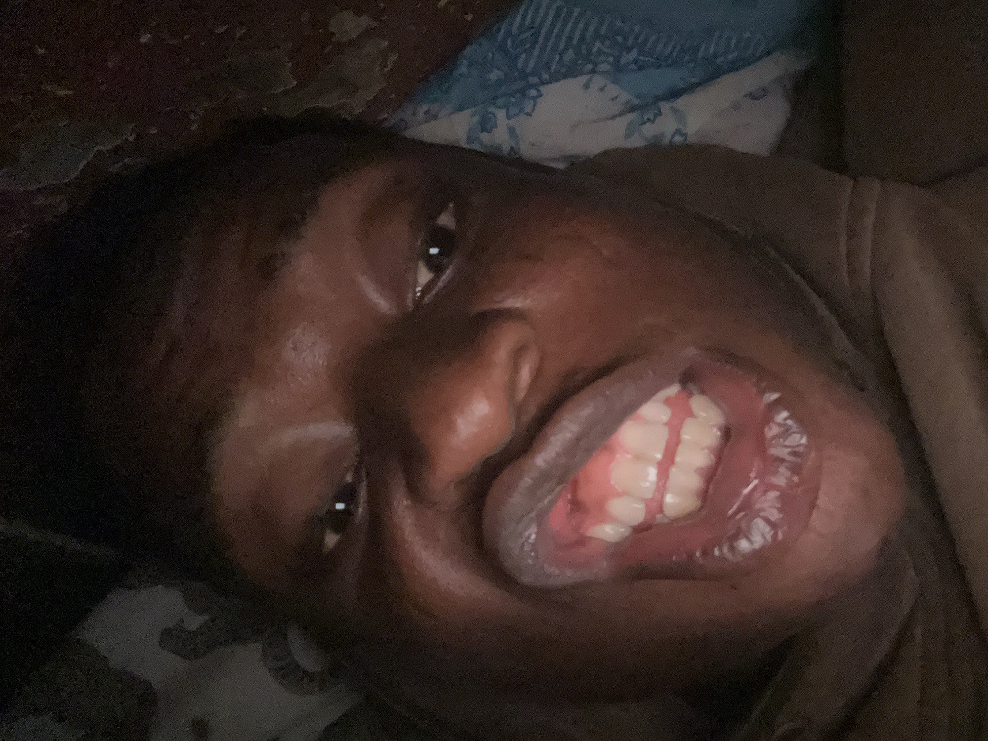 A close-up photograph depicts a person with dark skin lying on a bed. The person is looking at the camera with a visible smile, revealing their teeth and the inside of their mouth. The background includes bedding with a floral pattern. The location is Unknown, Unknown.
