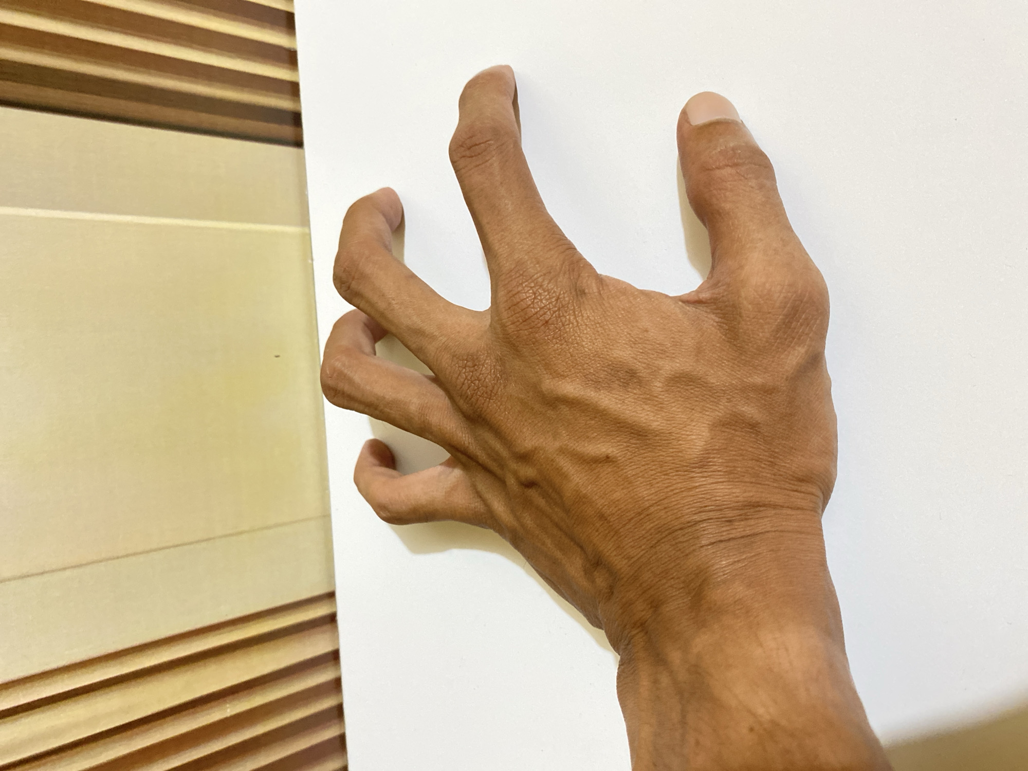 A tanned human hand with prominent veins is positioned against a white surface. The fingers are slightly curled. To the left of the hand is a wall with horizontal brown and beige stripes. The photograph was taken indoors, with no specific identifying information linking it to Tanjongkapai, Indonesia.