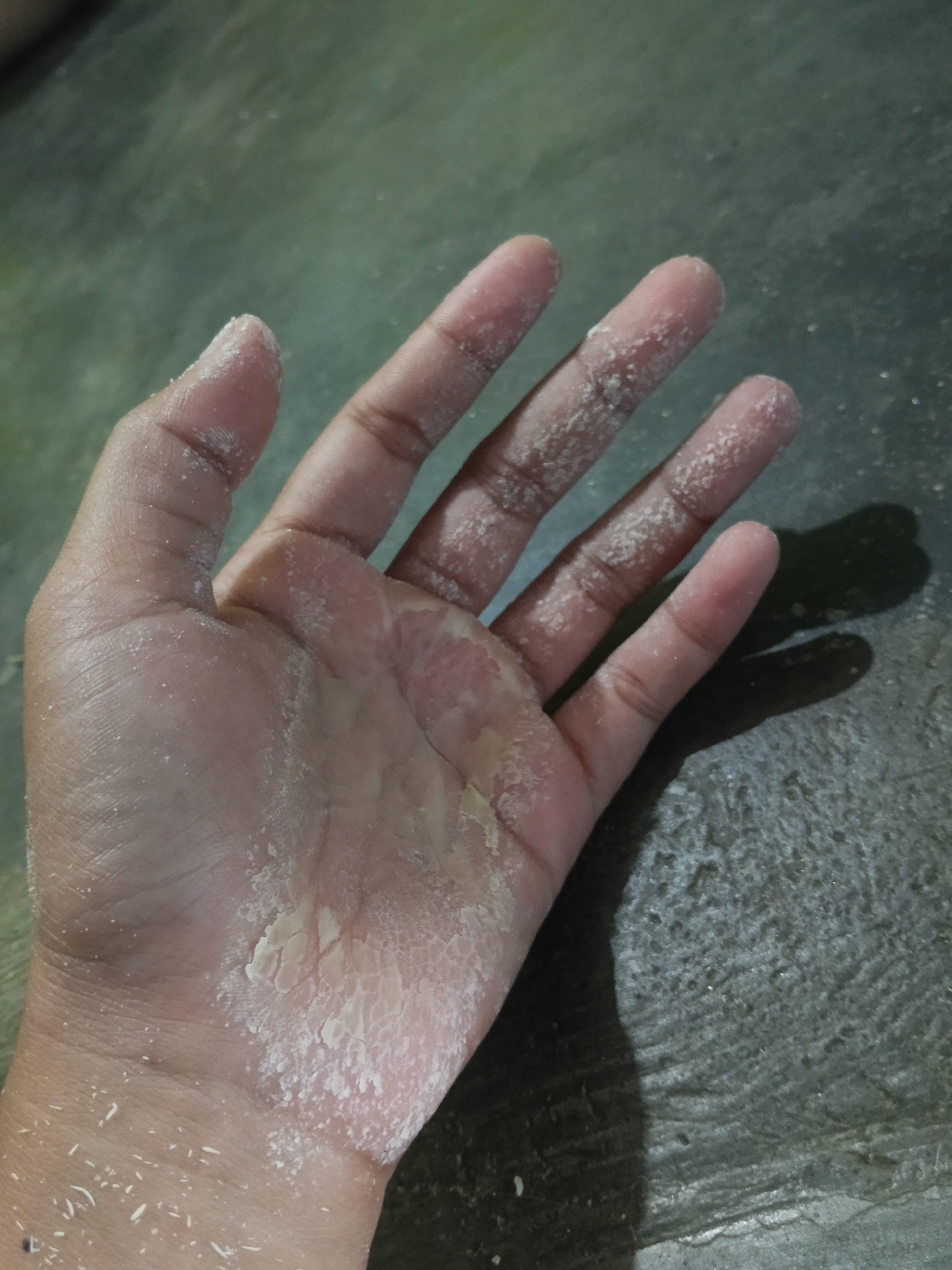 The image shows a close-up view of a person's left hand, palm facing upwards, resting on a dark, textured surface that appears to be a floor. The hand exhibits significant dryness and peeling of the skin, particularly on the palm and the base of the fingers. A white, powdery substance, possibly dust or residue, is visible on the skin and scattered across the surface. The fingers are slightly spread, with the fingernails visible and appearing normal. The lighting casts a shadow of the hand onto the surface to the right. The environment is consistent with an indoor setting in a residential or non-industrial area, such as a home in Lestari Indah, Indonesia.