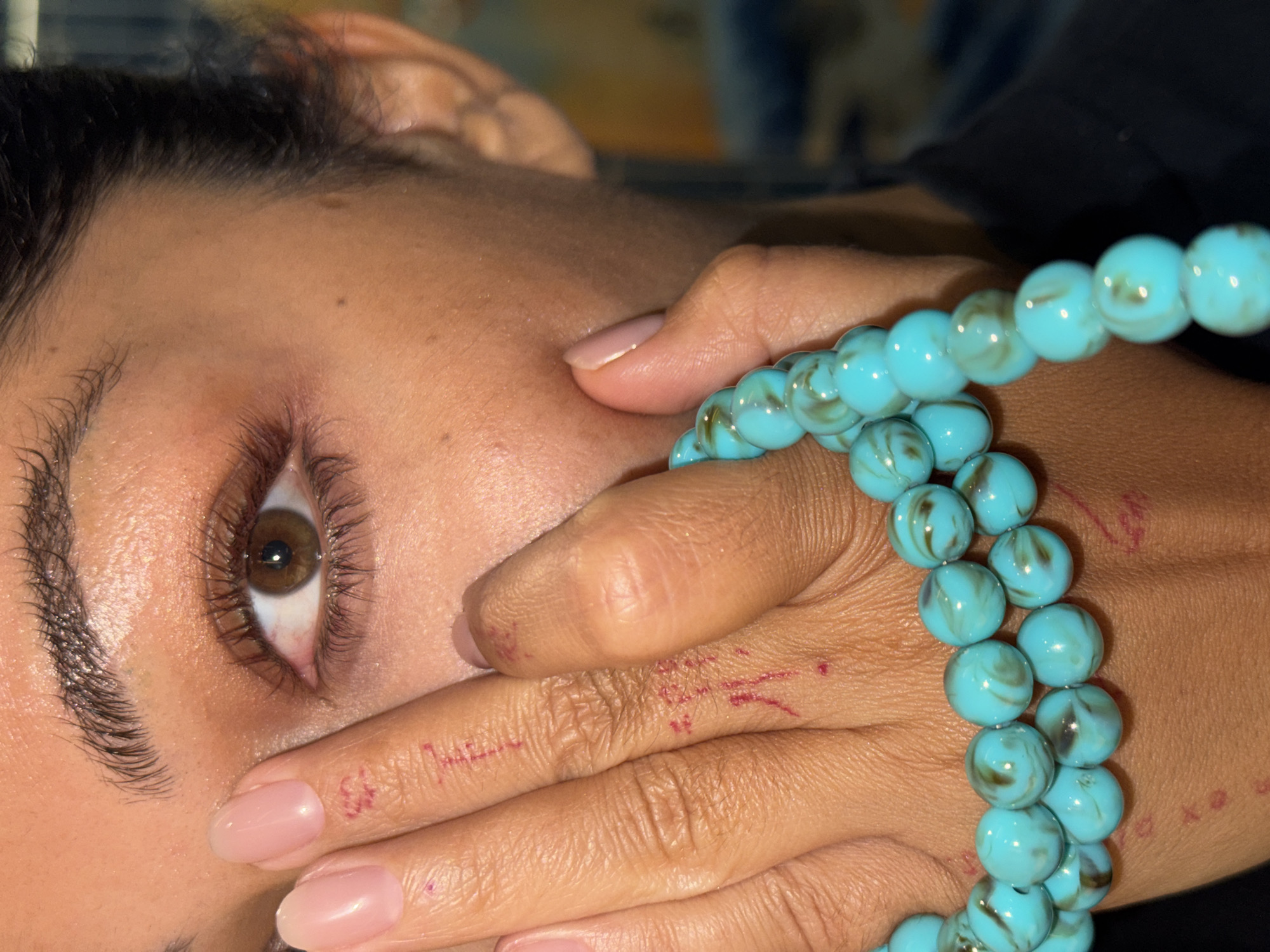 A close-up, angled view shows a person's face and hand. The person has dark hair, fair skin, and a brown eye. Their hand is partially covering their face, holding a double-stranded bracelet made of blue, marble-patterned beads. There are faint red markings on the fingers and hand. The background is blurred. The location is not discernible from the image.