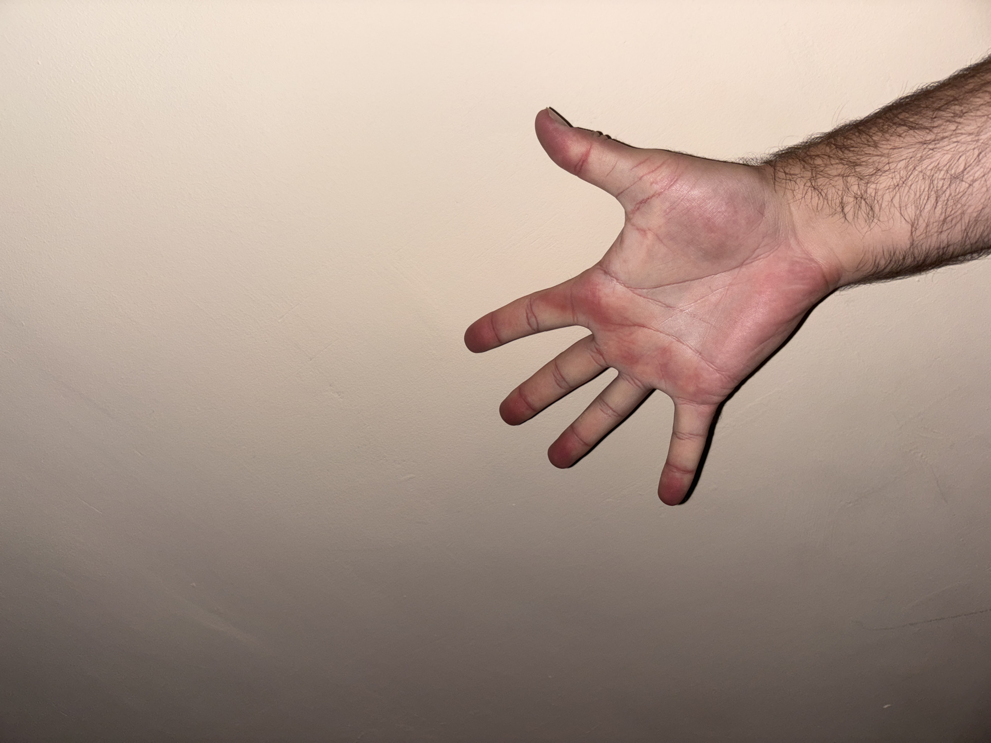 A person's right hand is open and extended towards the viewer against a plain, light-colored background. The hand is positioned in the upper right quadrant of the image, with the fingers spread apart. The skin on the palm appears slightly red, and there are visible lines and creases on the palm and fingers. The arm, which is hairy, extends from the left side of the hand into the frame. The background is a textured, light beige or cream color, possibly a wall or ceiling, with subtle variations in shading and some faint linear marks. The lighting creates shadows that emphasize the contours of the hand and arm, and also cast a slight shadow on the background. The overall impression is that of a static pose, possibly an invitation or a gesture. There is no discernible text in the image. The setting appears to be indoors with artificial lighting.