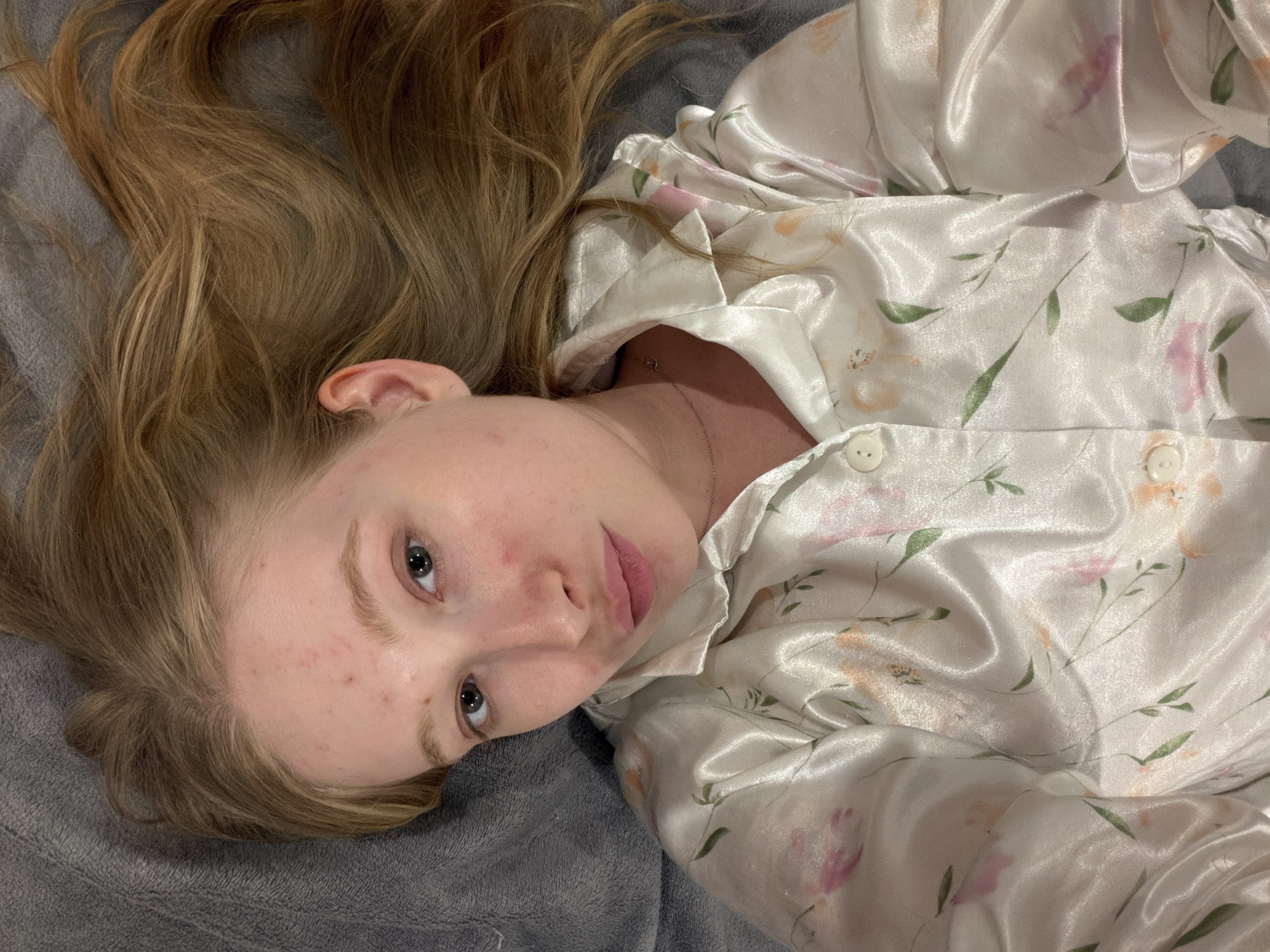 An eye-level shot depicts a young female, likely an adolescent or young adult, lying on her back on a grey, soft-textured surface, possibly a blanket or duvet. Her head is angled towards the upper left, and she looks directly at the camera with a neutral to slightly pensive expression.
She has long, light brown or blonde hair spread out on the grey fabric around her head and ear. Her skin is fair, with some visible acne or blemishes on her forehead, cheeks, and chin. Her eyes are light-colored, possibly blue or grey. She is wearing a light-colored (likely white or cream) silky or satin pajama shirt or top. The garment features a delicate floral pattern with soft pink, orange, and green leaf elements. The fabric is shiny and appears creased in places, indicating its soft nature. A thin silver necklace with a small pendant is visible around her neck, resting on her collarbone beneath the shirt's open collar. Buttons are visible on the shirt.
The background is entirely composed of the grey, soft fabric she is lying on. The overall scene suggests an indoor, relaxed setting. No specific activity is taking place other than the subject lying down and looking at the viewer. No text is visible in the image. The location context is Засечное, Russia.