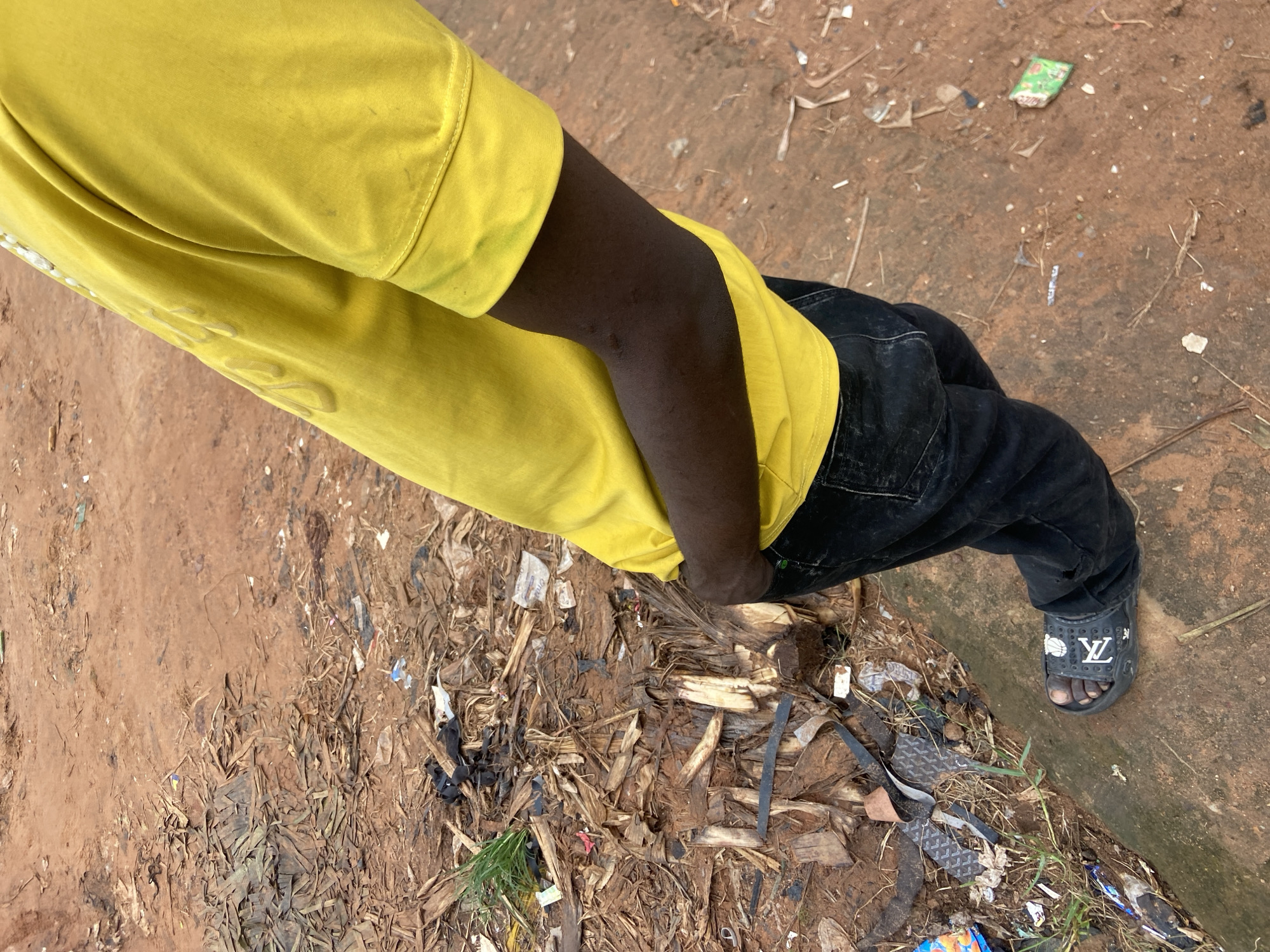 A person, with dark skin, is standing on a concrete curb in Nkpor, Nigeria. They are wearing a yellow t-shirt and black jeans. The person's right hand is in their back pocket. They are also wearing a black slide sandal on their left foot with a white pattern. The ground around them is covered in dirt, debris, and some dry vegetation.