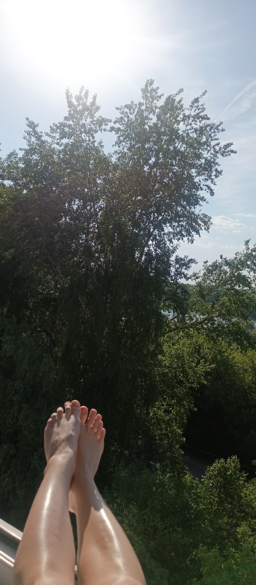 The image shows a pair of legs and feet in the foreground, set against a backdrop of lush green trees and a bright, slightly hazy sky. The legs appear to be resting on a metallic railing. The location is the city of Unknown, Unknown.