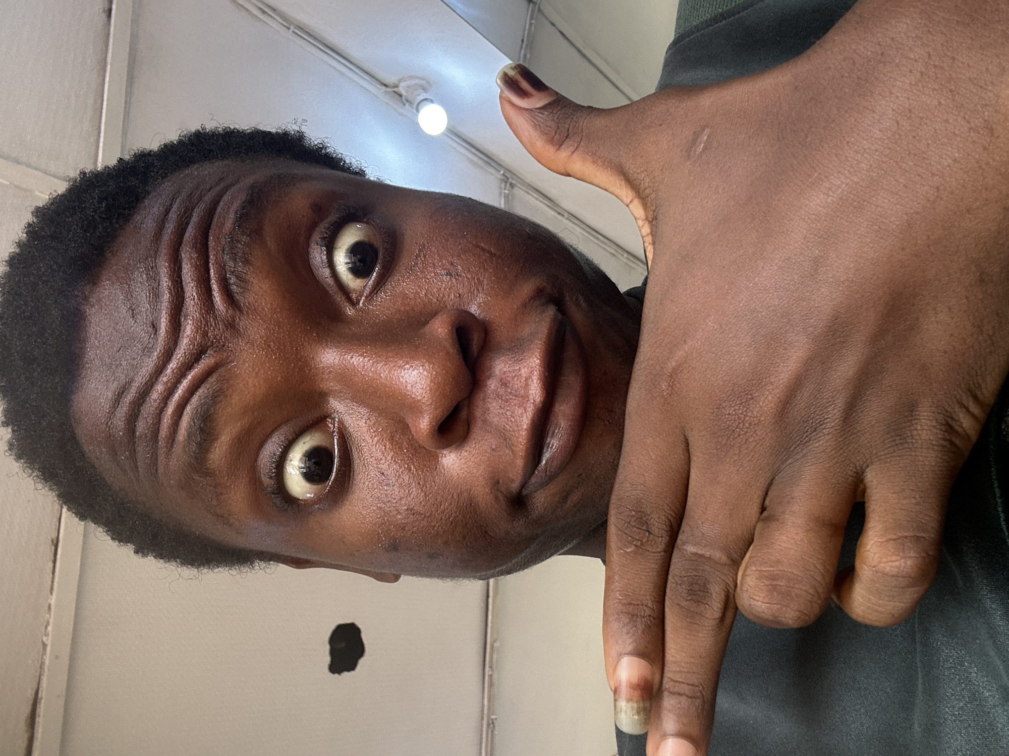 A close-up, tilted self-portrait of a dark-skinned person with wide eyes and a furrowed brow. The person's right hand is partially in the frame, with two fingers extended. The background is a white wall with a light fixture visible at the top. A dark smudge is present on the wall near the person's face. The location and city are unknown.