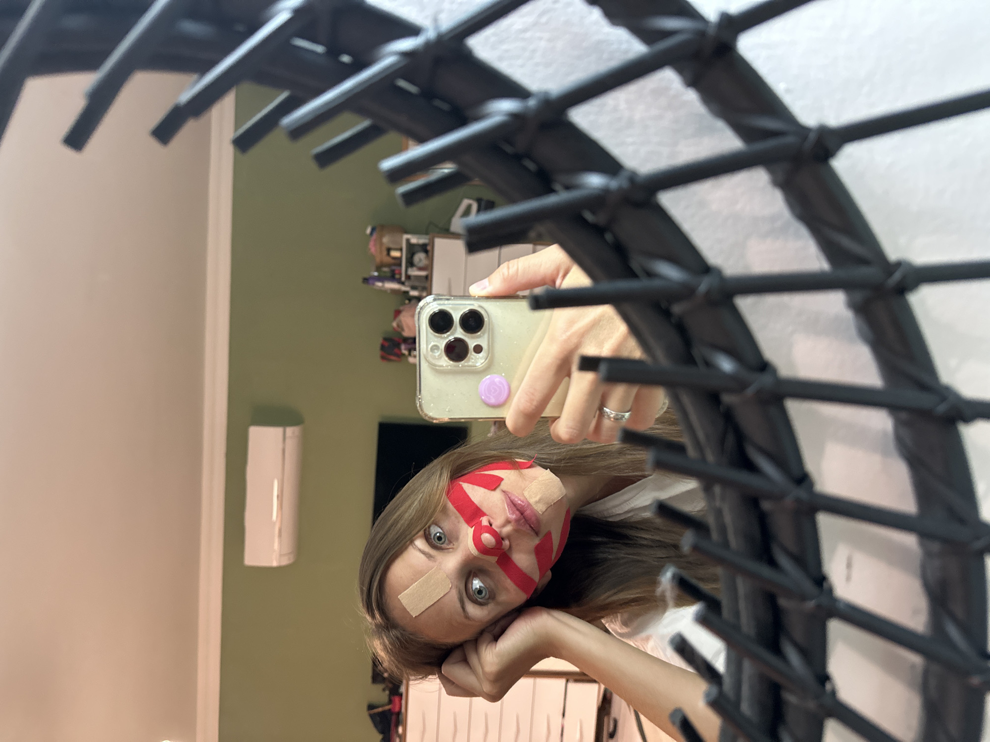 A woman is taking a selfie indoors. The woman has red and beige bandages on her face. She is holding a phone in her right hand. The background includes a green wall, a white wall, and furniture. A black metal structure is in the foreground. The location is unknown. The image provides no information about the city of Fethiye, Turkey.
