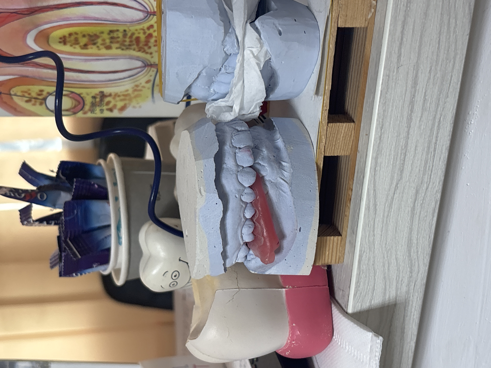 This image shows dental molds of upper and lower teeth, made of a light blue material, with a red partial denture. The molds are placed on a wooden stand and next to a cup filled with dental floss. A dental anatomy chart is visible in the background, along with a white cabinet. It's not possible to determine the specific location in Sofia, Bulgaria from the image provided.