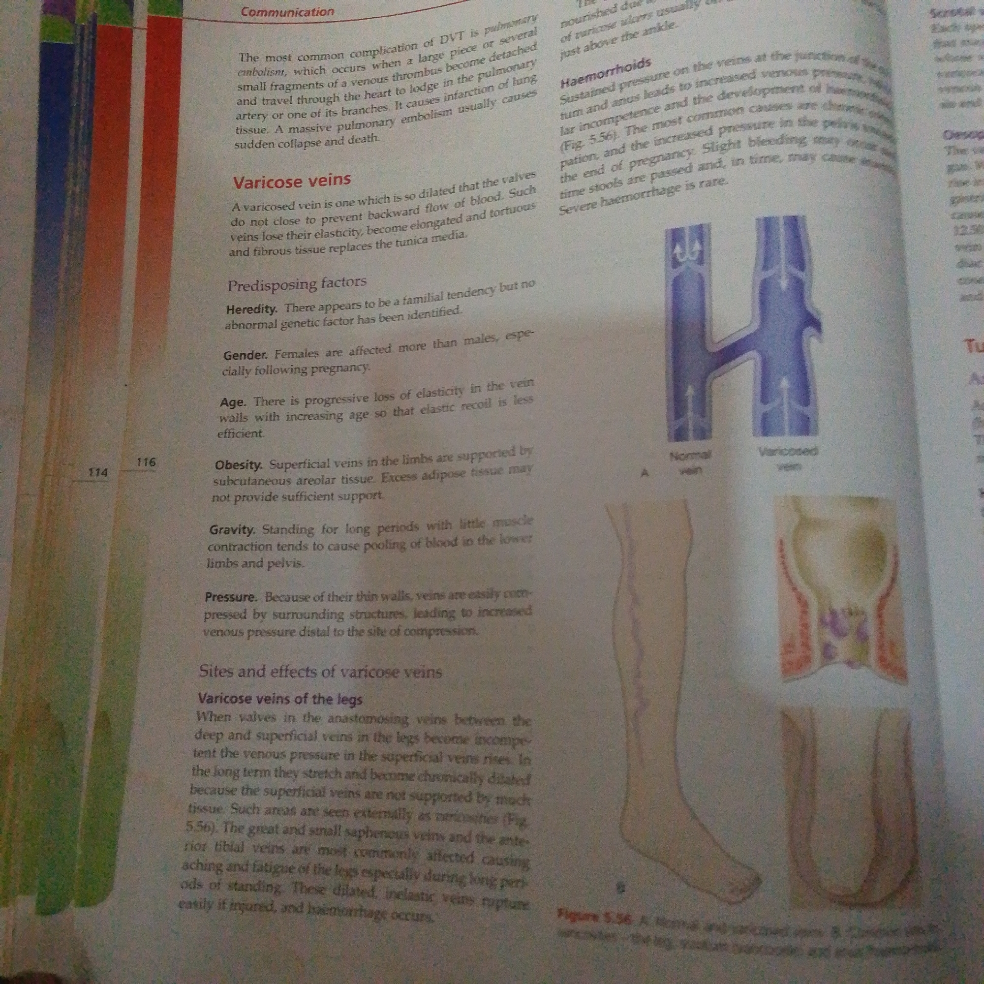This media file is a photograph of an open book, displaying text and illustrations related to human anatomy and health. The primary subject is the printed content on the pages. There are two pages visible, with the left page featuring a section titled "Communication" and an illustration partially visible on the far left. The right page is predominantly filled with text, broken into sections such as "Haemorrhoids," "Scrotal," and "Tu," along with diagrams.
The text discusses medical conditions like Deep Vein Thrombosis (DVT), pulmonary embolism, varicose veins, and hemorrhoids, explaining their causes, symptoms, and predisposing factors. Specific terms like "pulmonary embolism," "varicose veins," "haemorrhoids," "heredity," "gender," "age," "obesity," "gravity," and "pressure" are visible, along with page numbers "114" and "116."
The illustrations include a diagram illustrating normal and varicose veins, labeled "Normal vein" and "Varicose vein." Another diagram shows a cross-section of the leg with visible veins and a diagram of what appears to be the anal region. A further illustration on the right page depicts a leg with visible varicose veins.
The scene is a still, indoor environment, likely a study or library, with the book laid open. There are no people or specific setting cues like time of day or weather visible. The focus is entirely on the educational material presented in the book. The visible text and diagrams suggest the context is a biology or medical textbook. The location context provided (Jalingo, Nigeria) is not visually evident in the image itself.