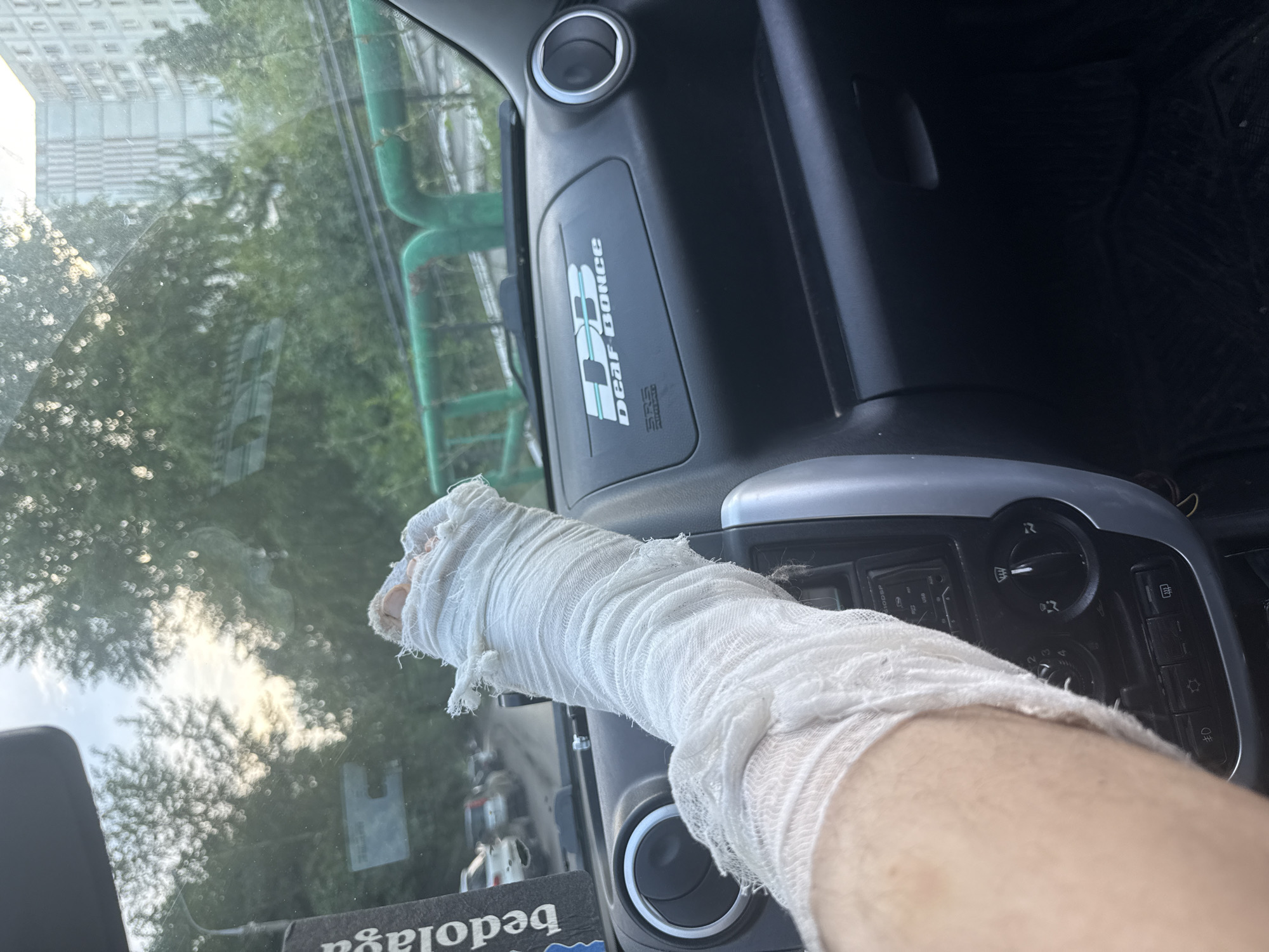 The image shows a person's bandaged arm inside a vehicle, likely a car or truck, looking out through the windshield. The arm is wrapped in white bandages, with some areas appearing frayed. The dashboard of the vehicle is visible, with a circular air vent and some buttons. A logo is also visible on the dashboard, which reads "DEAR GONCE" in white text with a stylized blue design. Outside the vehicle, trees and buildings can be seen, suggesting an urban or suburban setting. The lighting indicates it is daytime, possibly late morning or afternoon, with sunlight filtering through the trees, creating a dappled effect on the windshield. The scene appears to be a casual one, with the focus on the bandaged arm and the view through the car window. Some text is visible on a sticker on the lower part of the windshield, upside down, reading "bedolaga", which means "unfortunate person" in Russian. There are no explicit emotional cues conveyed beyond the visual of an injured limb. The location context of Samara, Russia, is provided as external information.