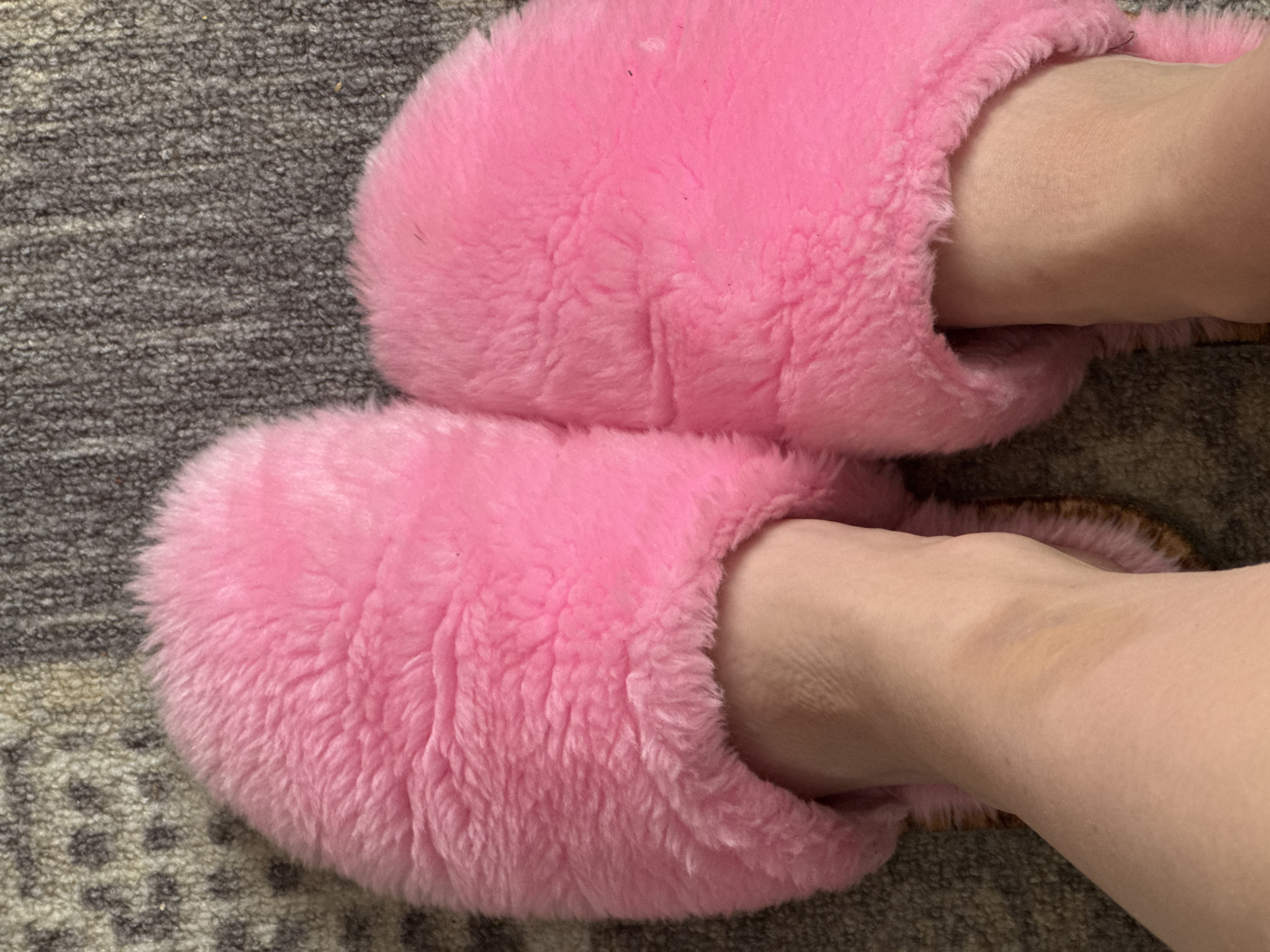 The image presents a close-up, overhead view of a person's feet wearing two vibrant pink, fluffy slippers. The slippers are open-toed and cover the top and sides of the feet, appearing soft and voluminous with a shaggy texture.
The person's fair-skinned feet and ankles are visible emerging from the slippers. On the right ankle, there is a distinct area of yellowish-brown discoloration, suggesting a bruise or healing mark.
The feet are resting on a patterned rug or carpet, which serves as the background. The rug features a dense, mottled texture in varying shades of dark gray and brown, with subtle lighter patterns. The setting is indoors, implying a home or private space, and the activity is simply wearing comfortable footwear. There are no discernible texts, specific location cues beyond an indoor setting, or indications of the time of day.